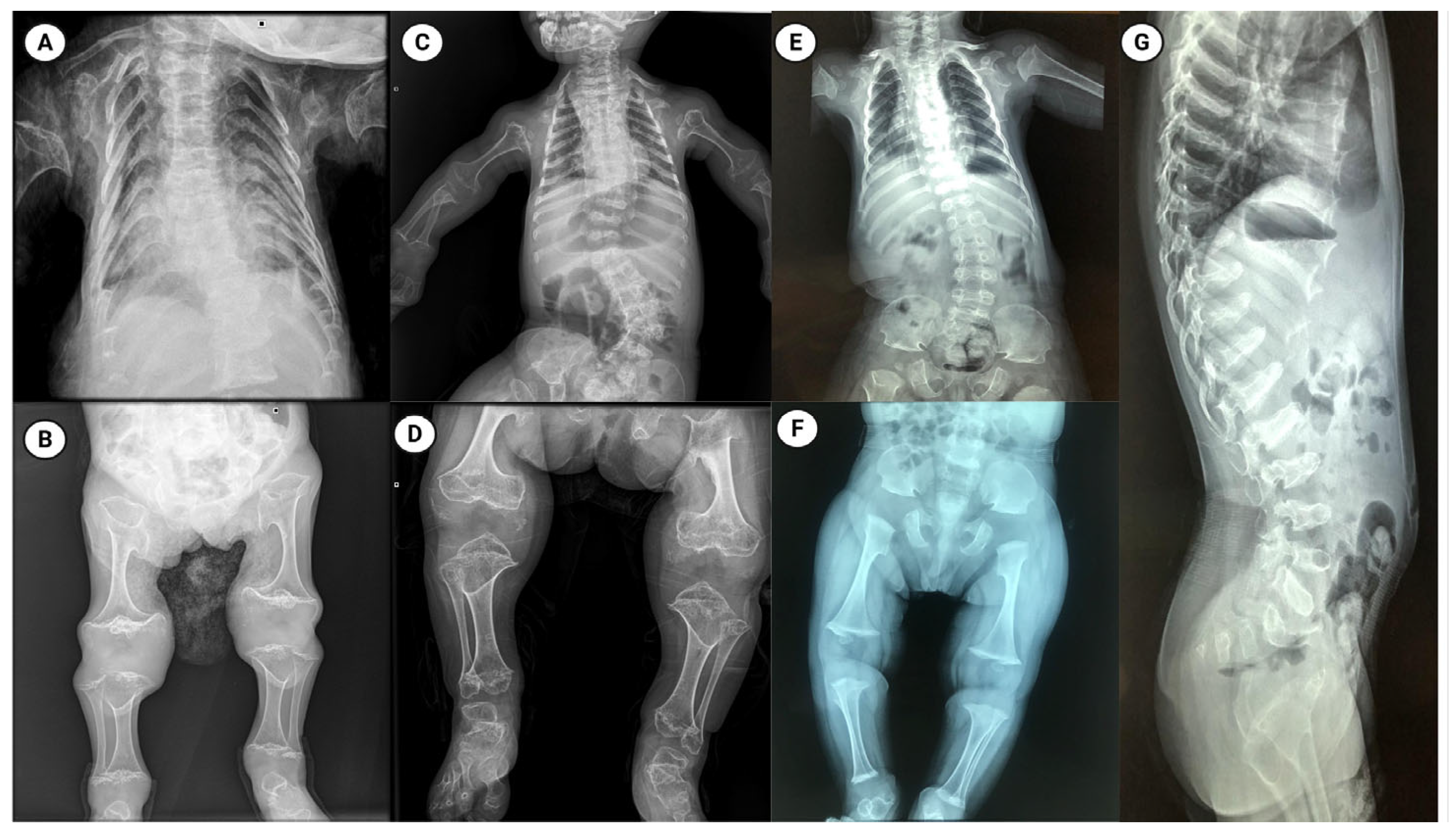 Ijms 26 09783 g001 Ijms 26 09783 g001