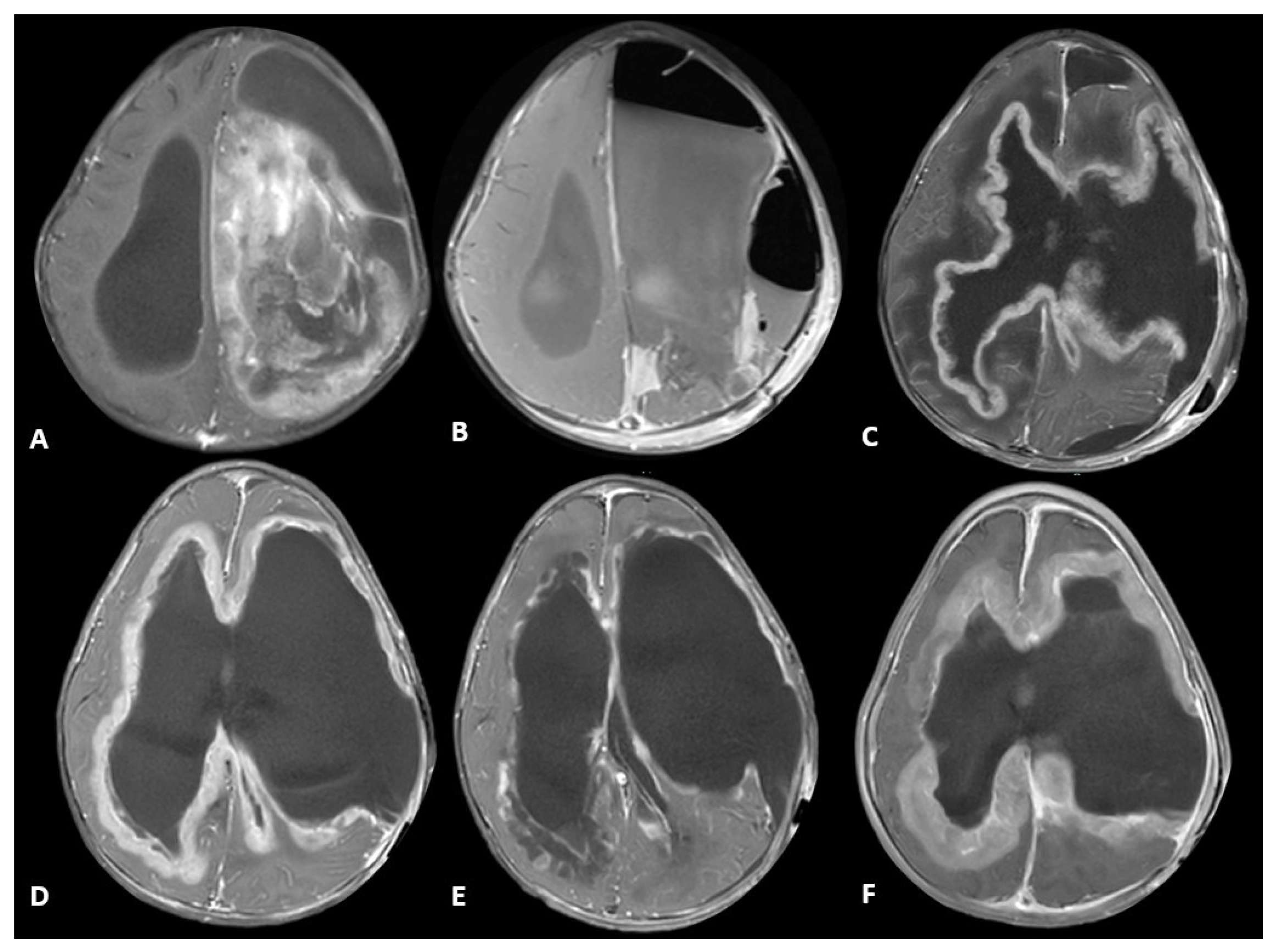 Ijms 26 09864 g001 Ijms 26 09864 g001