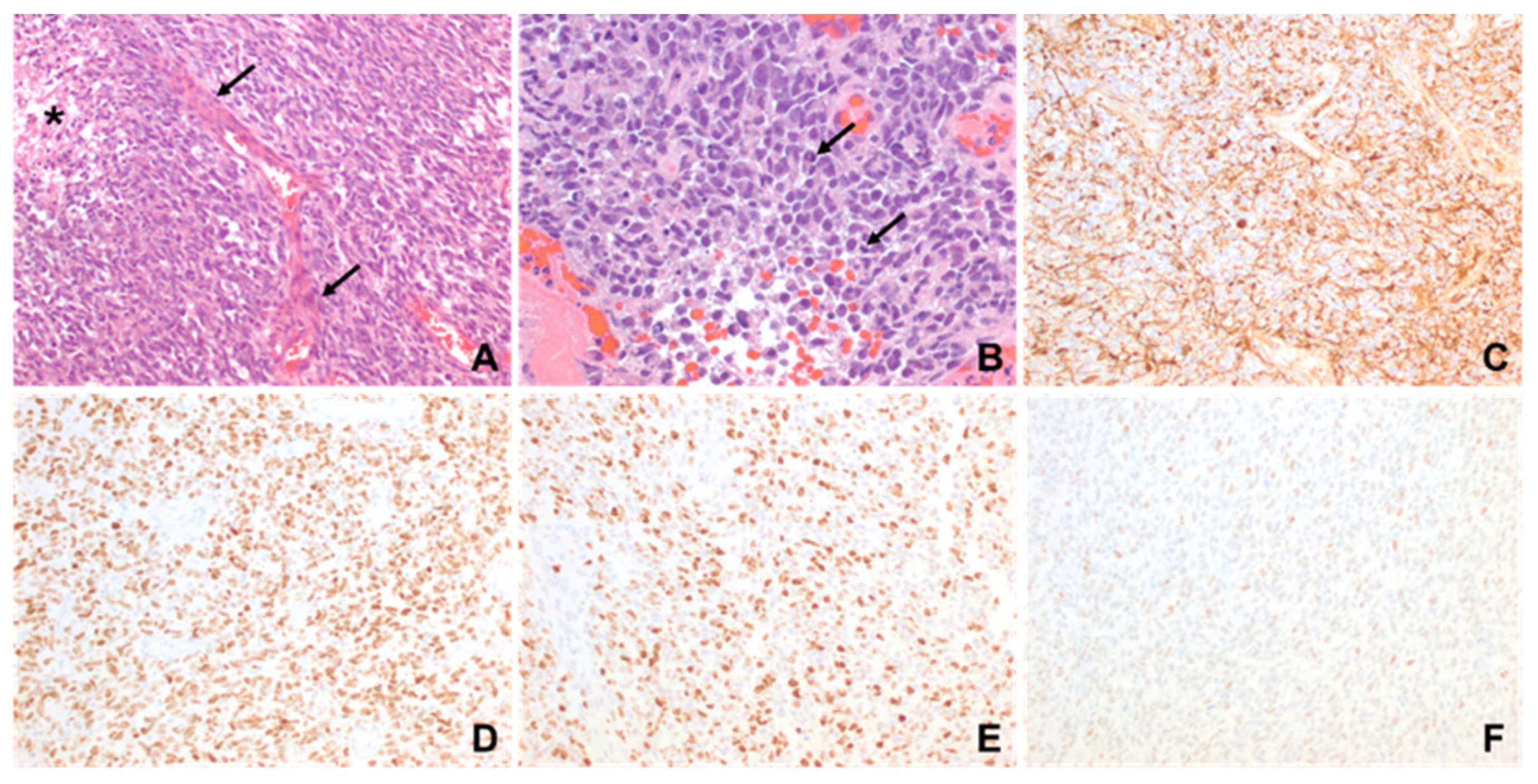 Ijms 26 09864 g002 Ijms 26 09864 g002