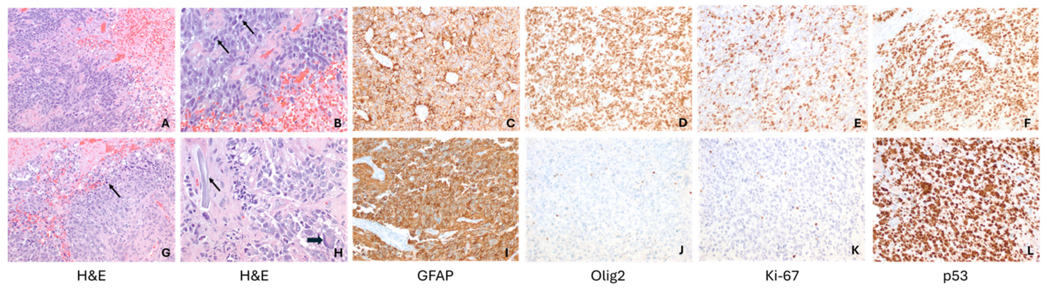 Ijms 26 09864 g004 Ijms 26 09864 g004