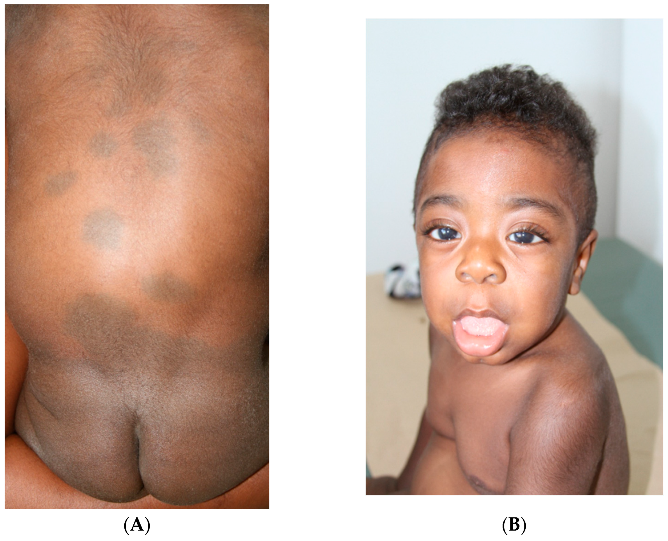 Ijms 26 10418 g001 Ijms 26 10418 g001