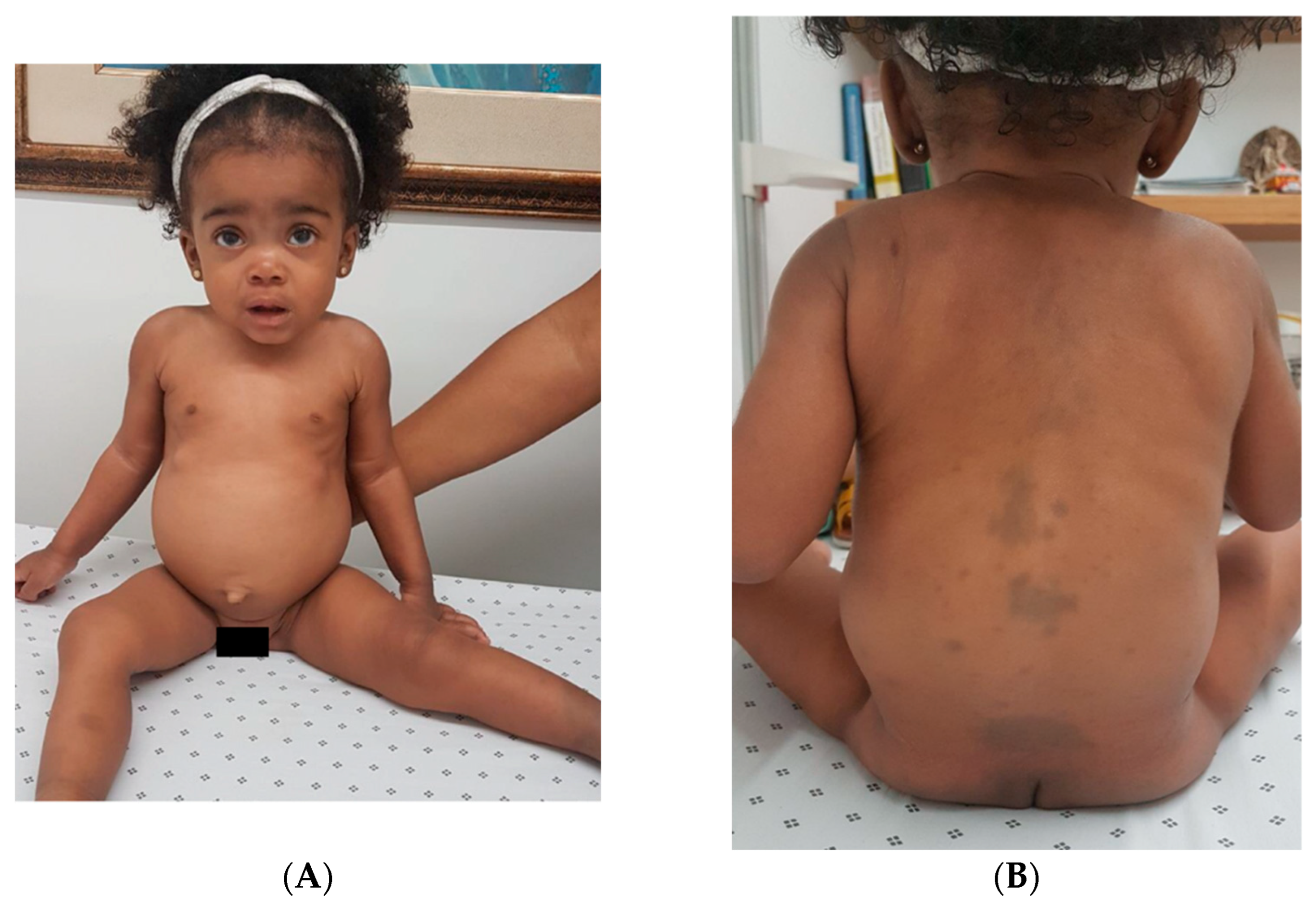 Ijms 26 10418 g002 Ijms 26 10418 g002