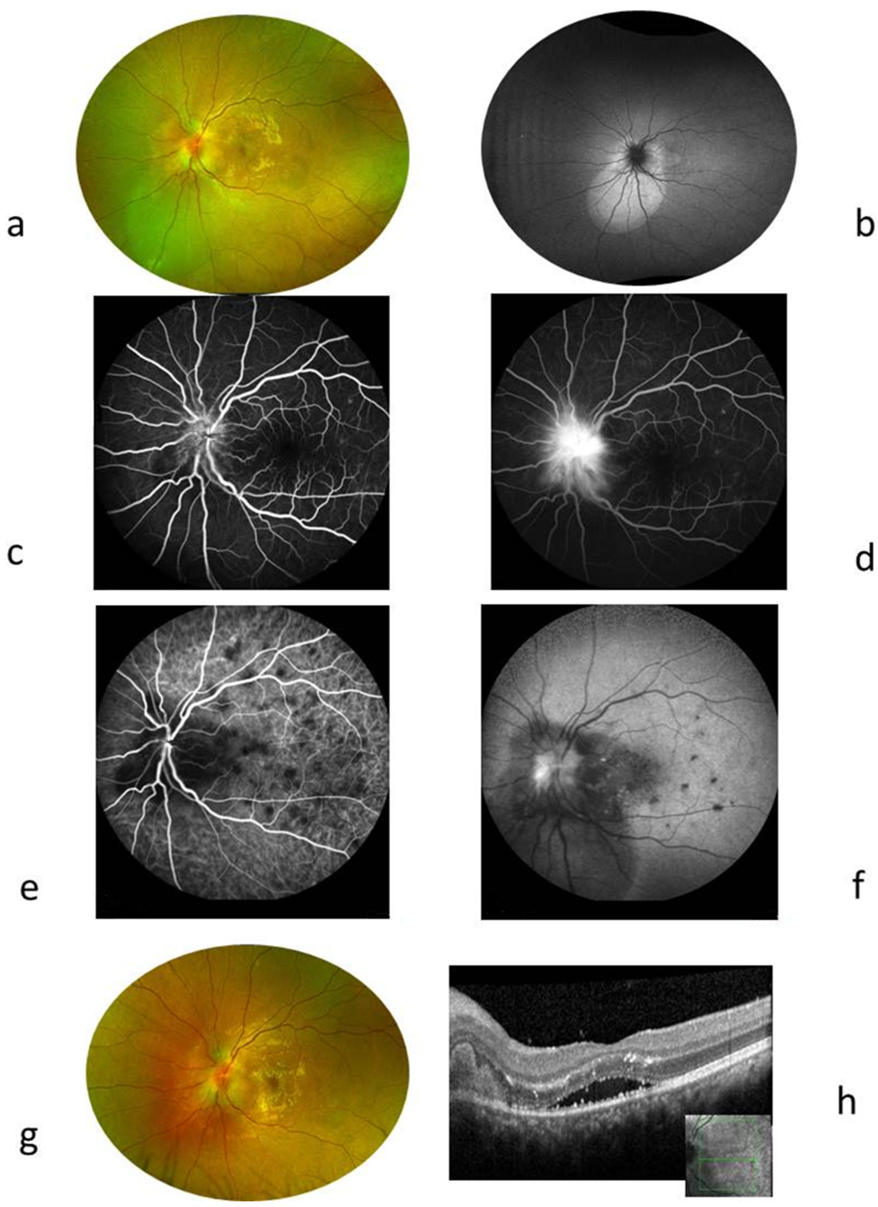 Ijms 26 10421 g005 Ijms 26 10421 g005