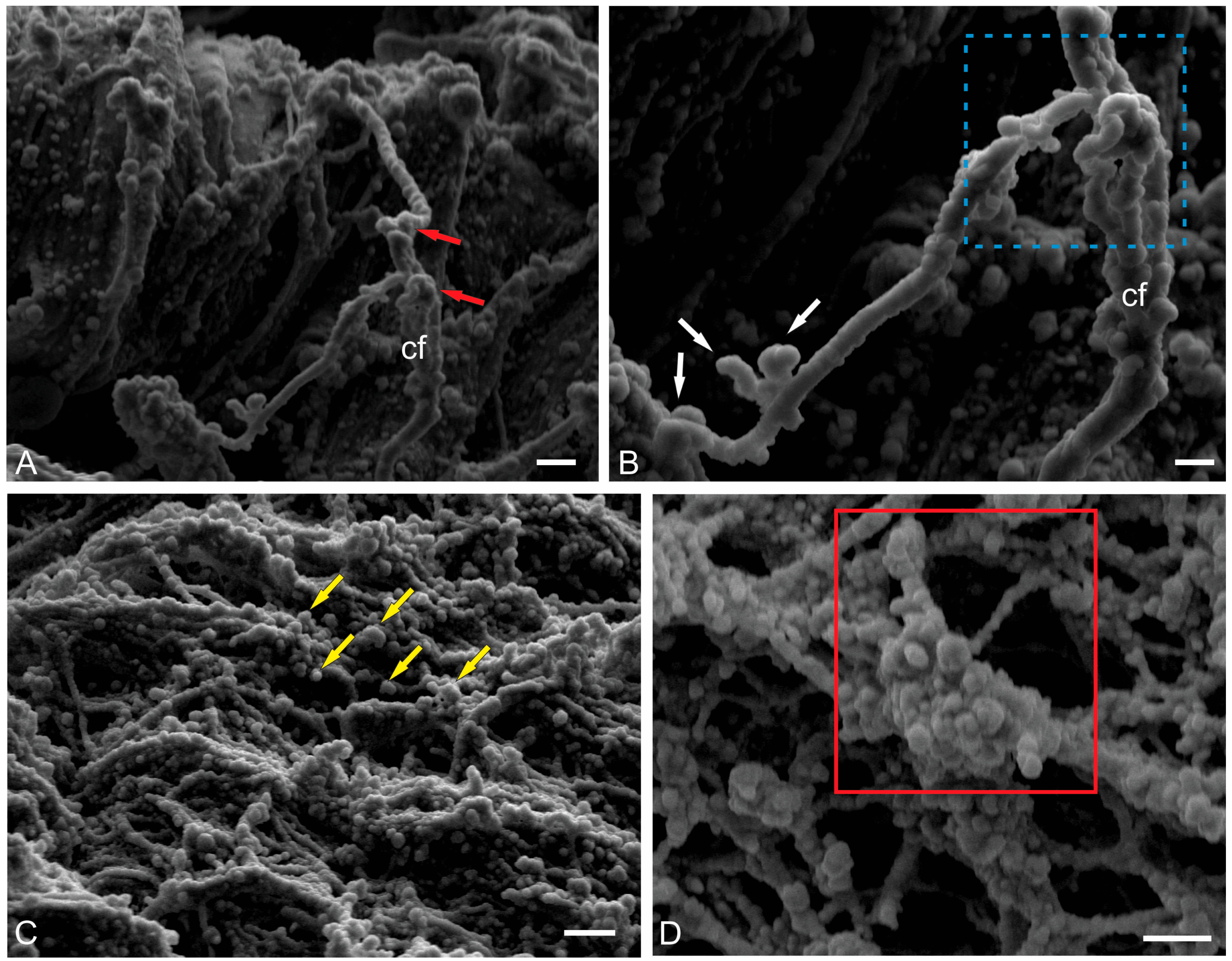 Ijms 26 11123 g006 Ijms 26 11123 g006