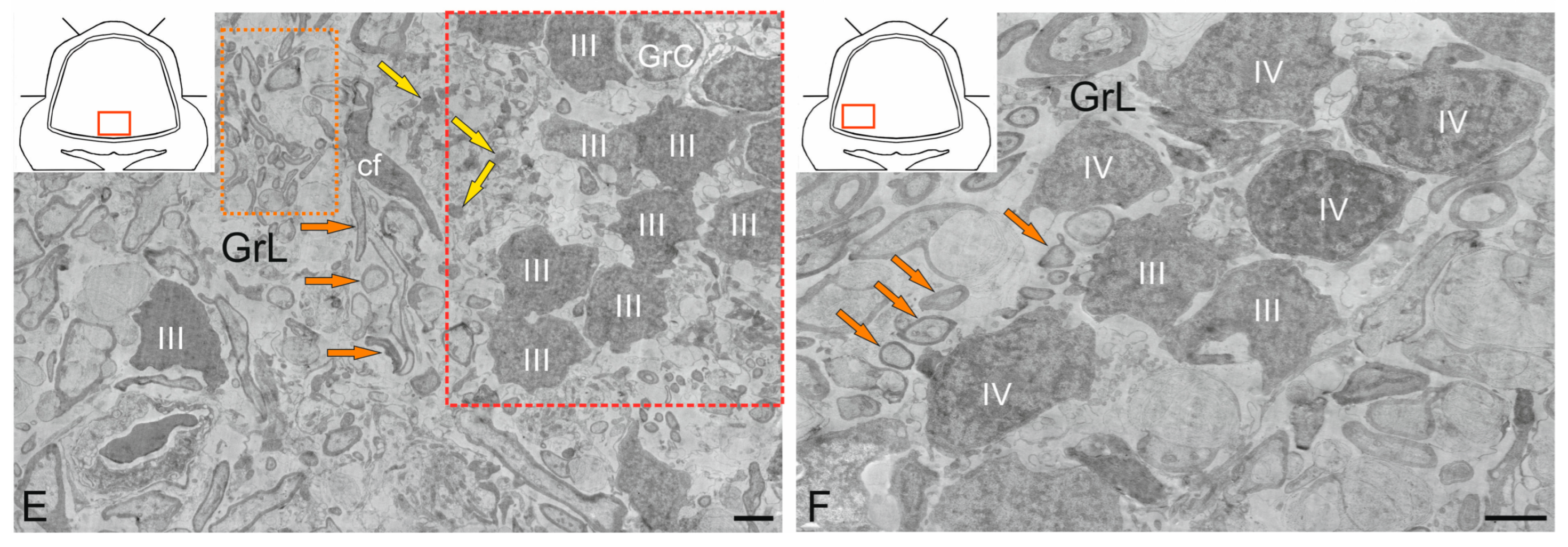 Ijms 26 11123 g010b Ijms 26 11123 g010b