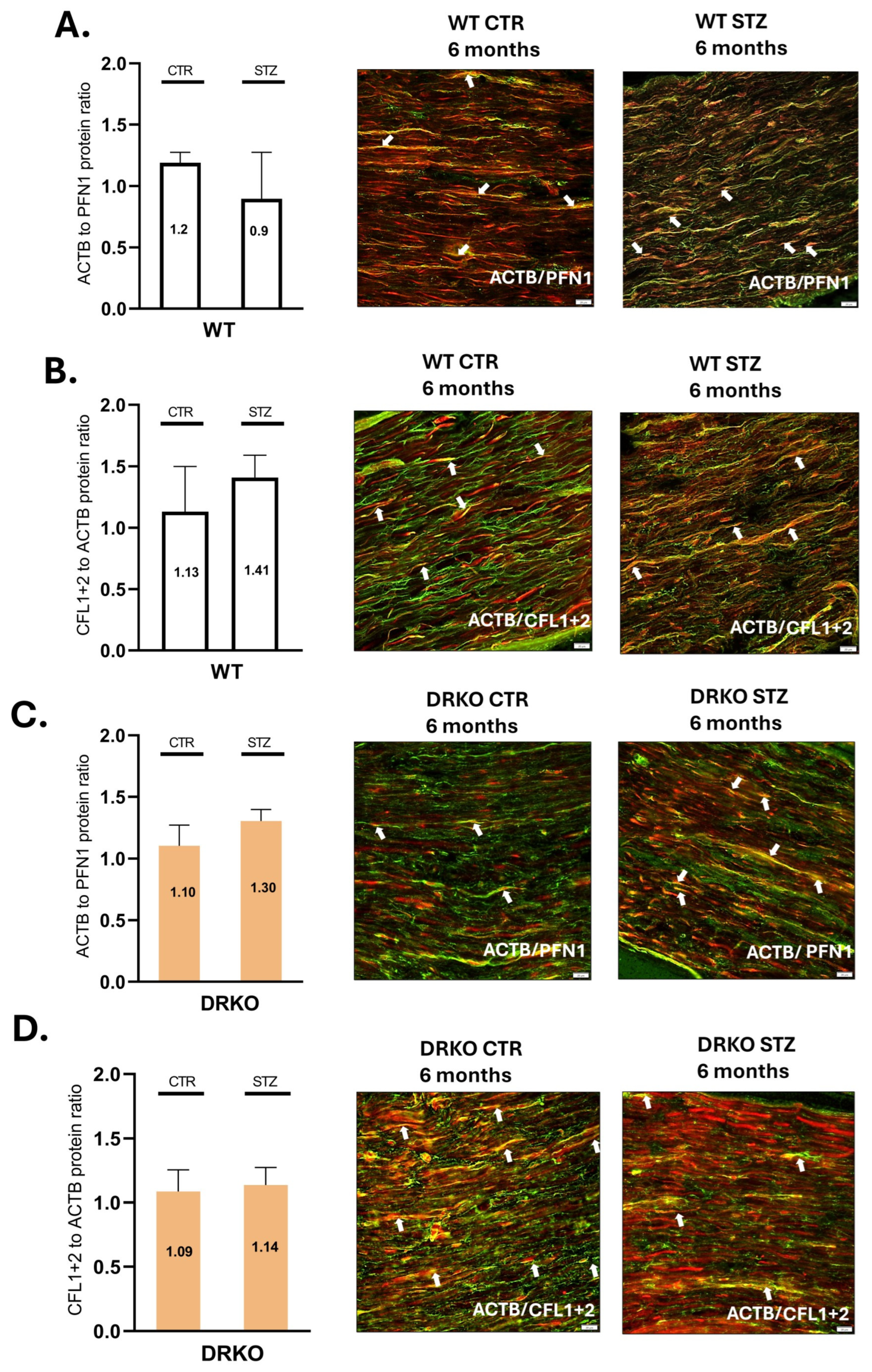 Ijms 26 11182 g003 Ijms 26 11182 g003