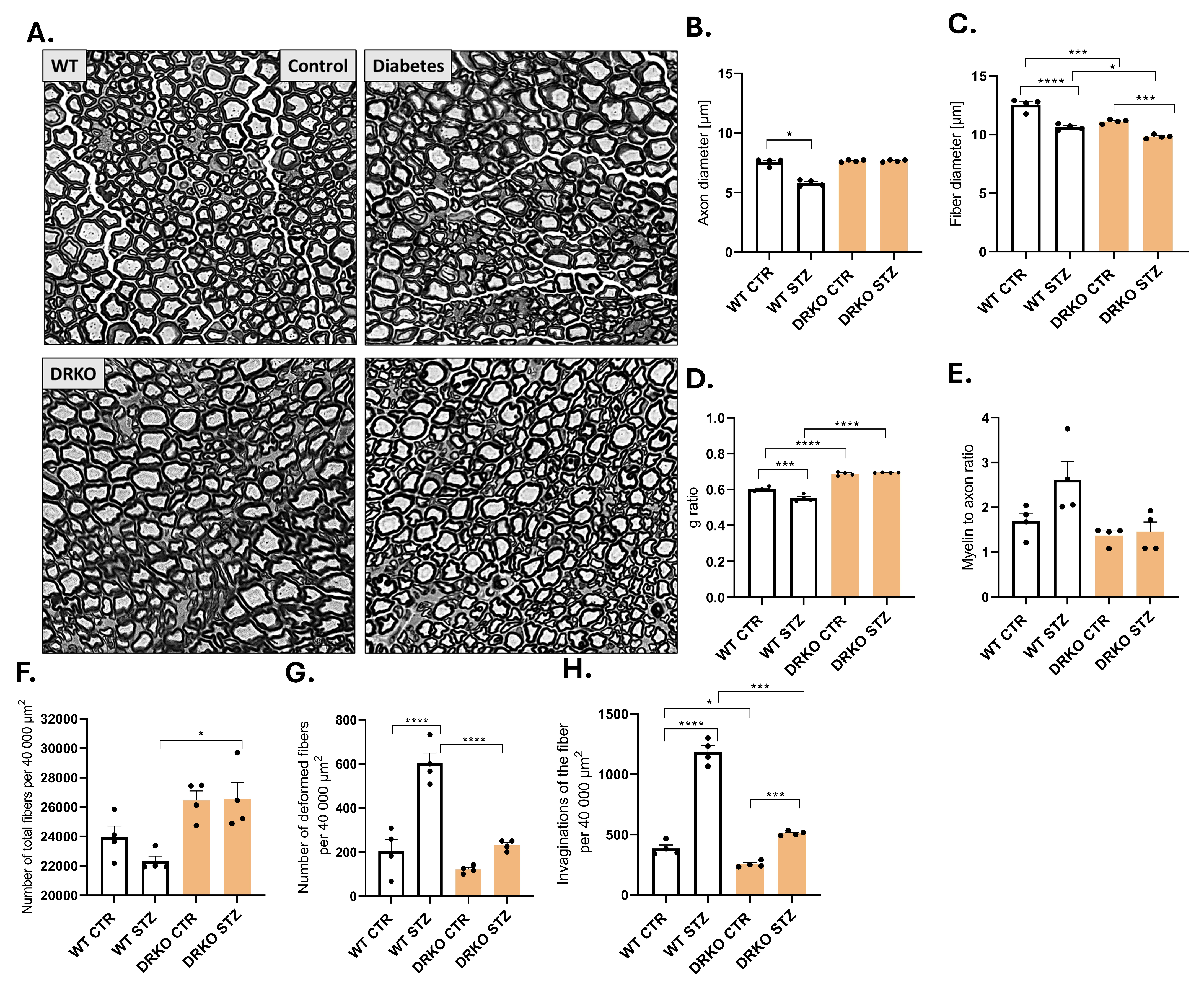 Ijms 26 11182 g005 Ijms 26 11182 g005
