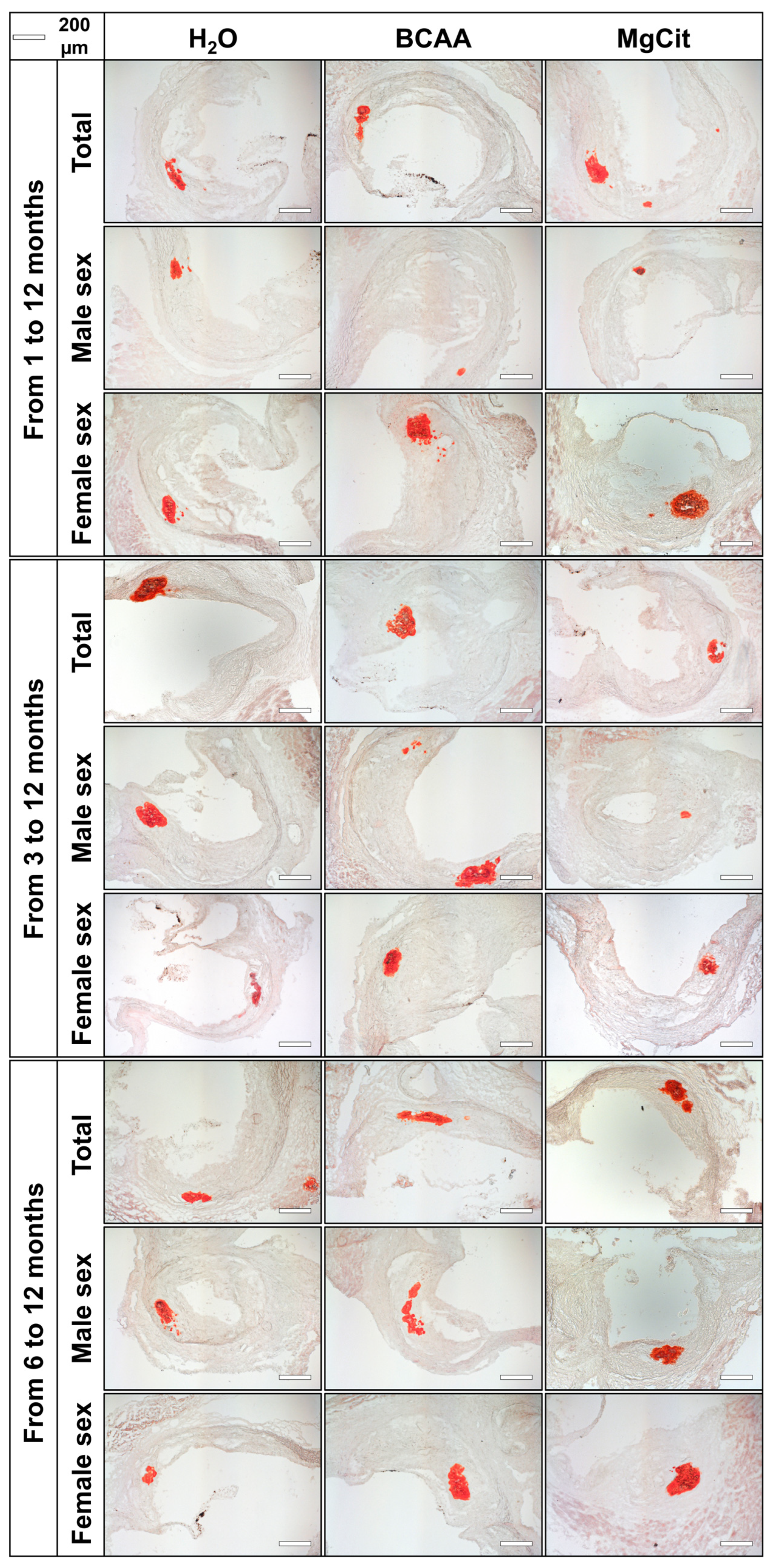 Ijms 26 11259 g006 Ijms 26 11259 g006