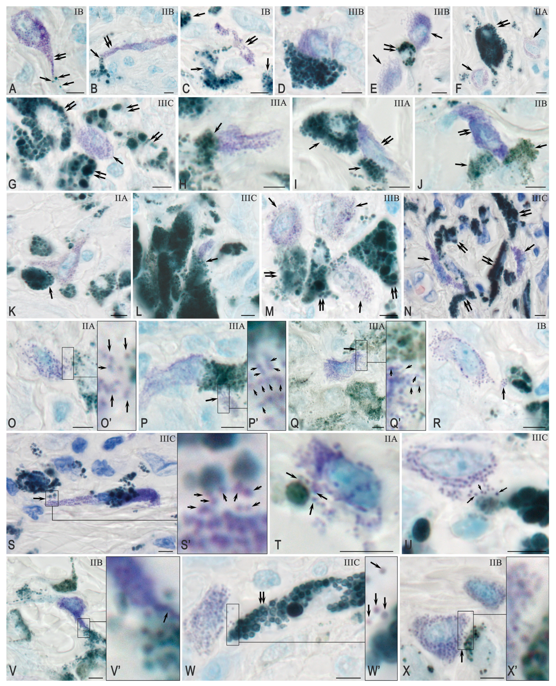 Ijms 26 11313 g002 Ijms 26 11313 g002