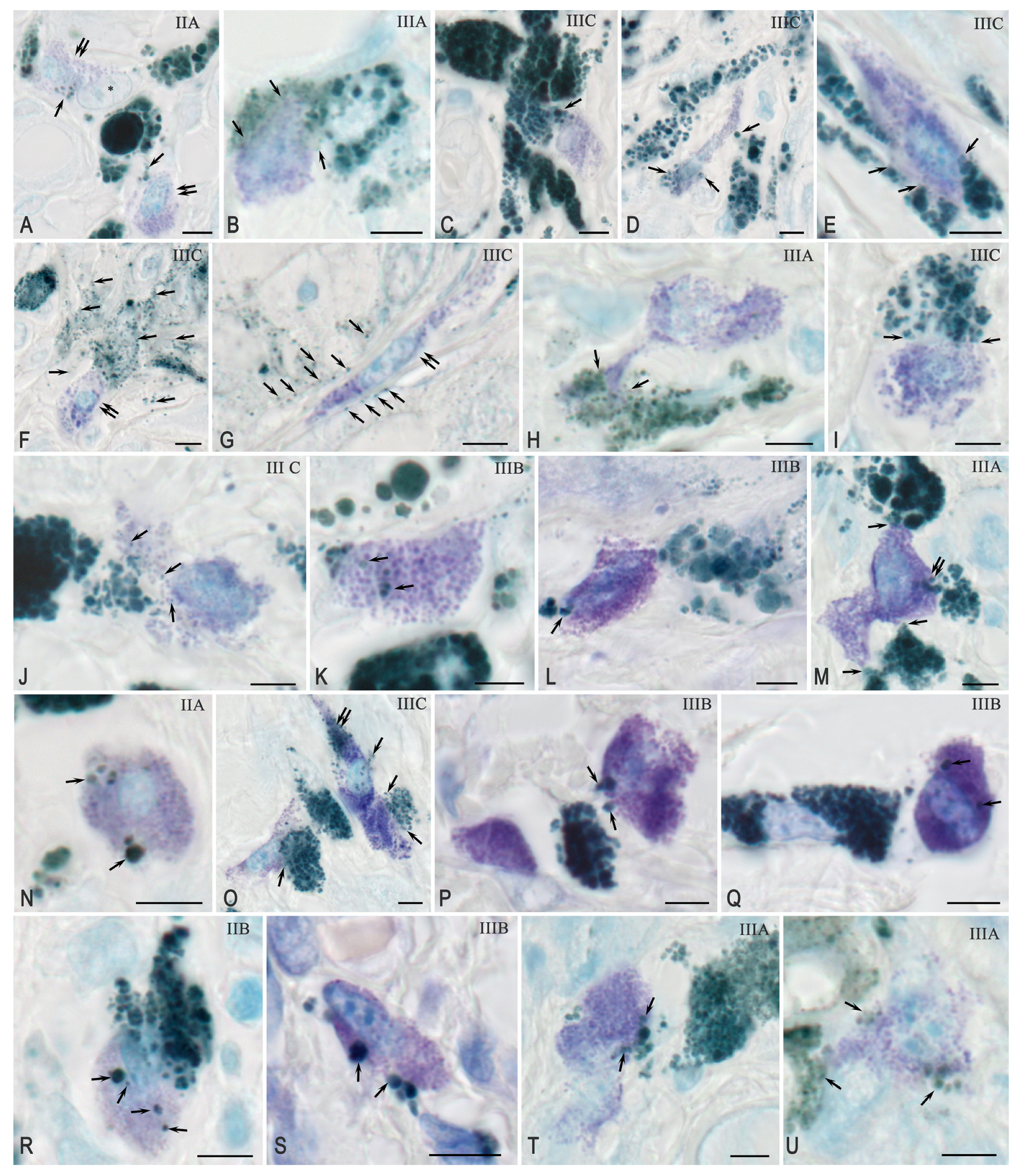 Ijms 26 11313 g003 Ijms 26 11313 g003