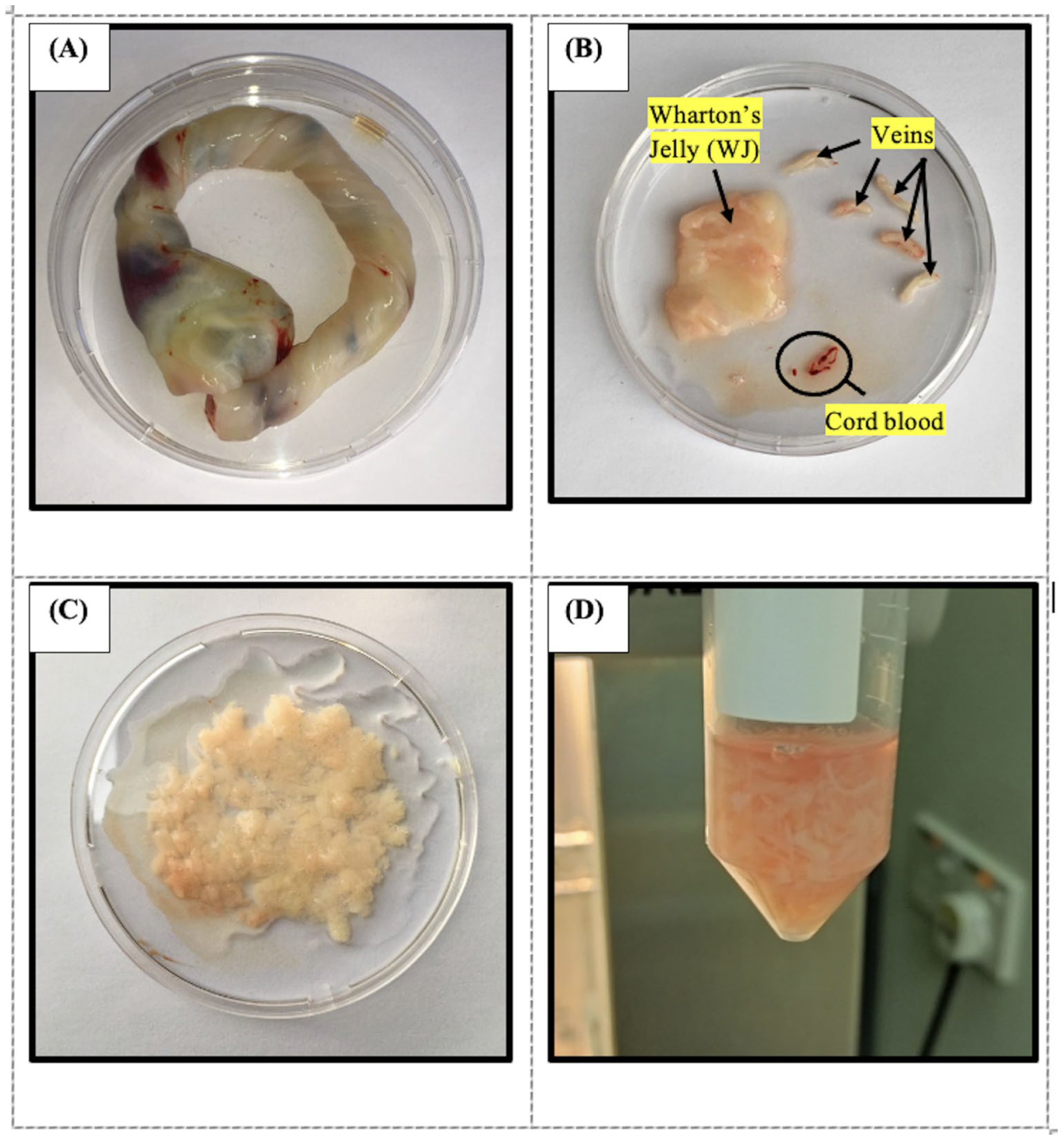 Ijms 26 11760 g011 Ijms 26 11760 g011