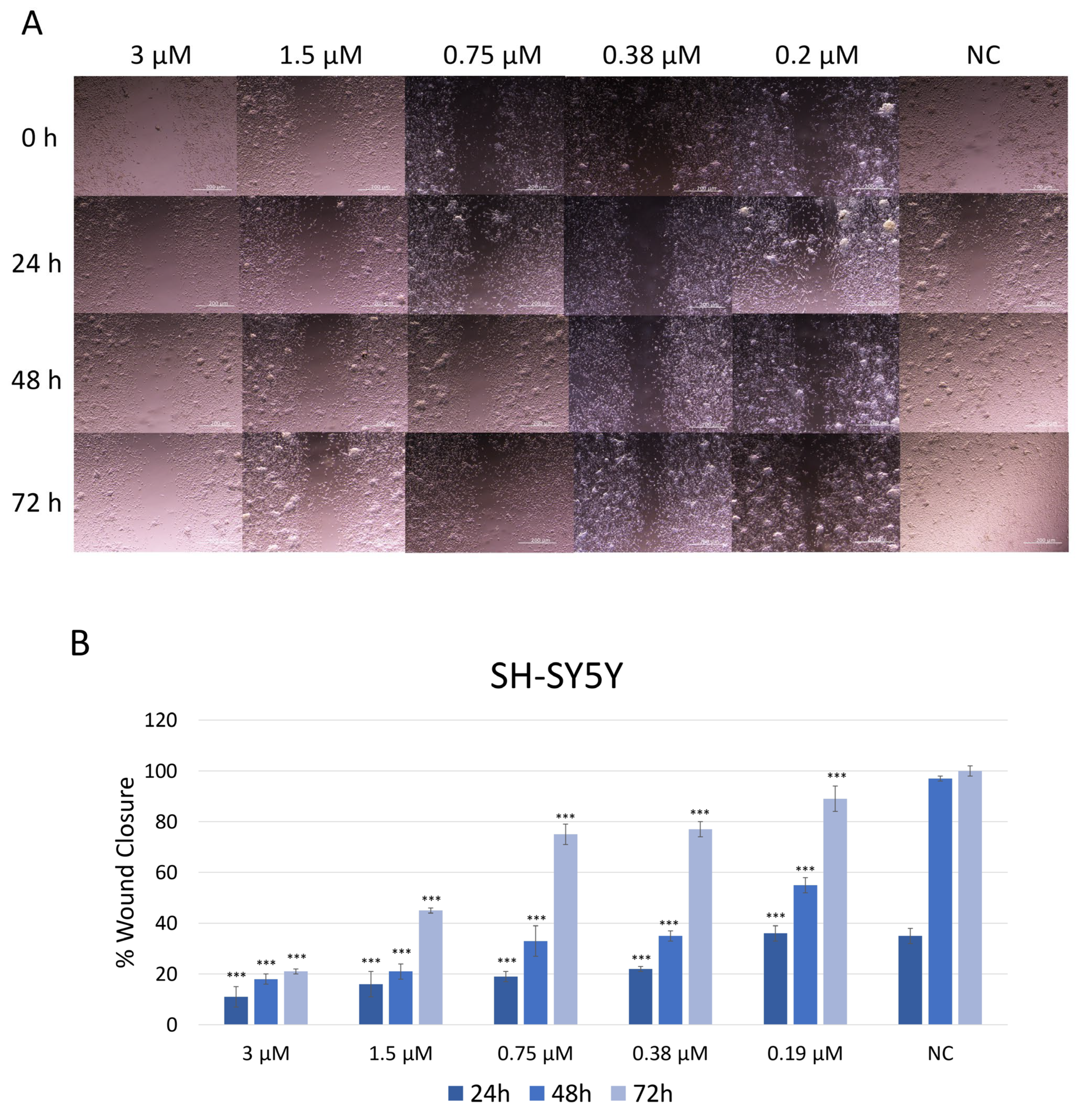 Ijms 26 11894 g004 Ijms 26 11894 g004