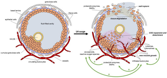 glutathione treatment and parkinson& 39 Glutathione S-transferase: A keystone in Parkinson's disease pathogenesis  and therapy