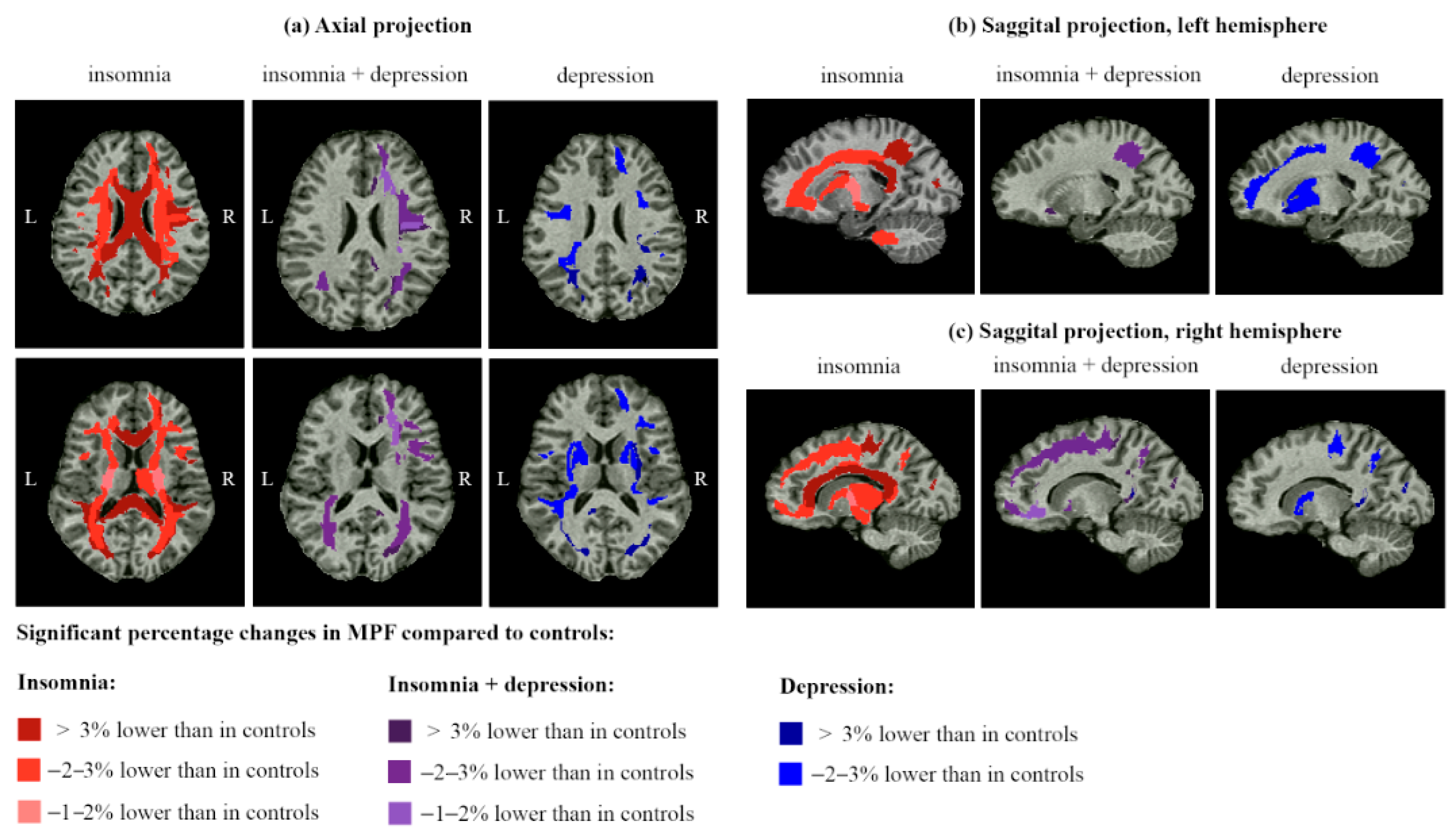 Ijms 26 12141 g004 Ijms 26 12141 g004