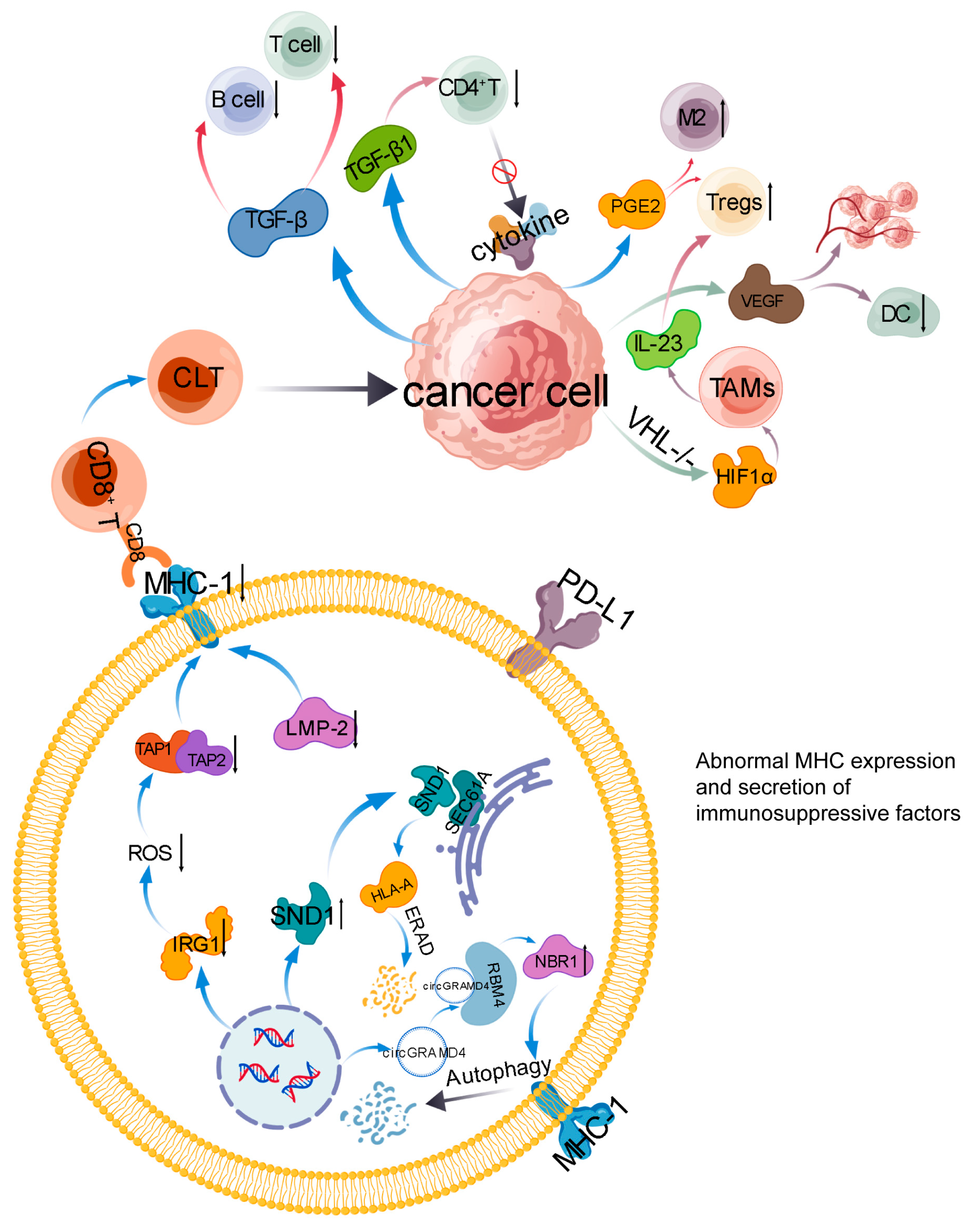 Immune Escape in Renal Cell Carcinoma: Latest Research and Treatment ...