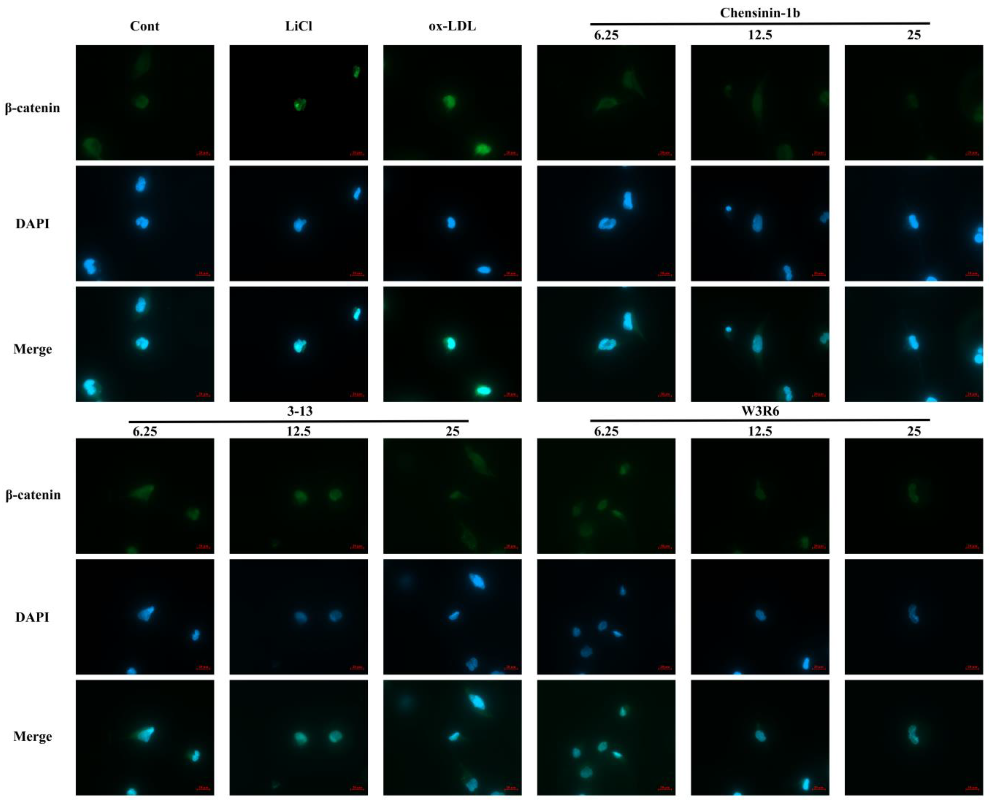 Antimicrobial Peptide Chensinin-1b Suppresses Inflammatory