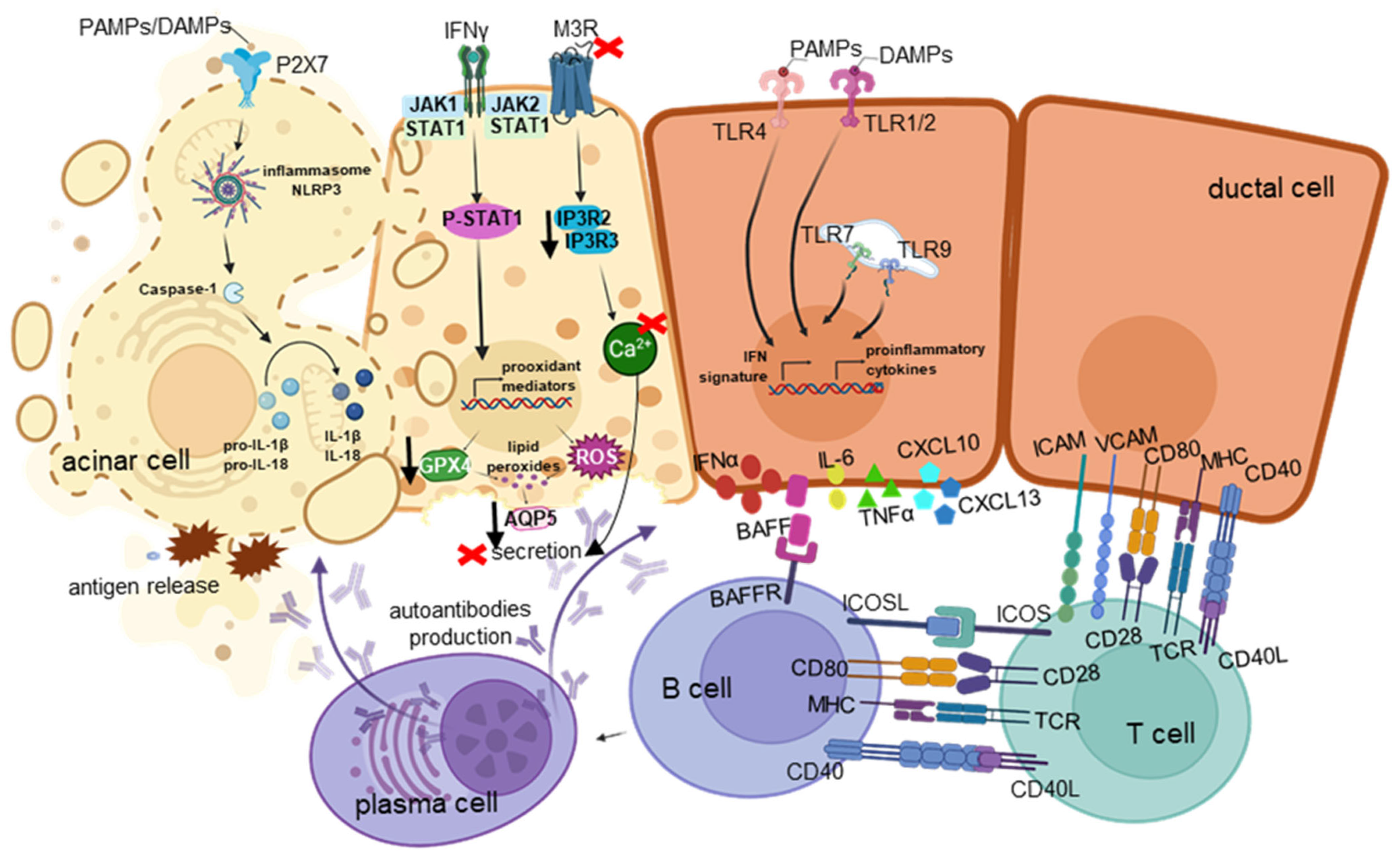 Molecular Insights into Oral Manifestations in Sjögren's Disease
