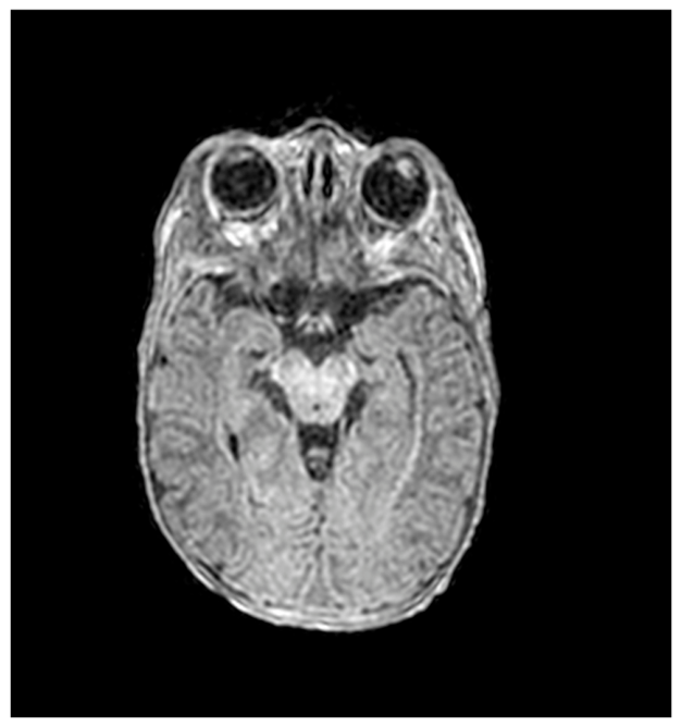 Ijms 27 04163 g004