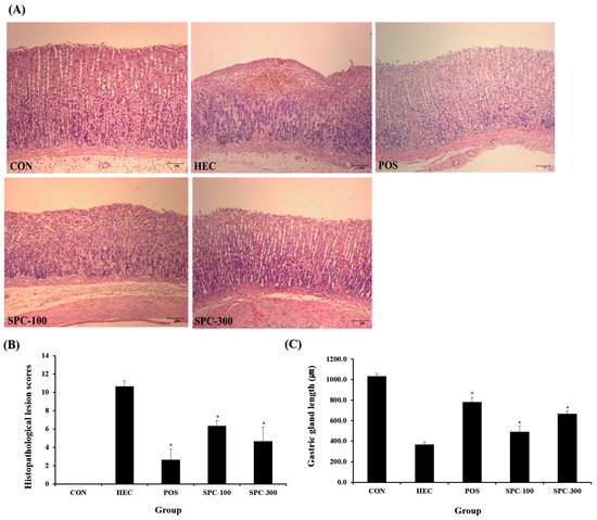 Gastroprotective Effects of Salvia plebeia via Antioxidant and  MAPK/NF-B-Mediated Anti-Inflammatory Mechanisms in Ethanol/HCl-Induced  Gastric Injury