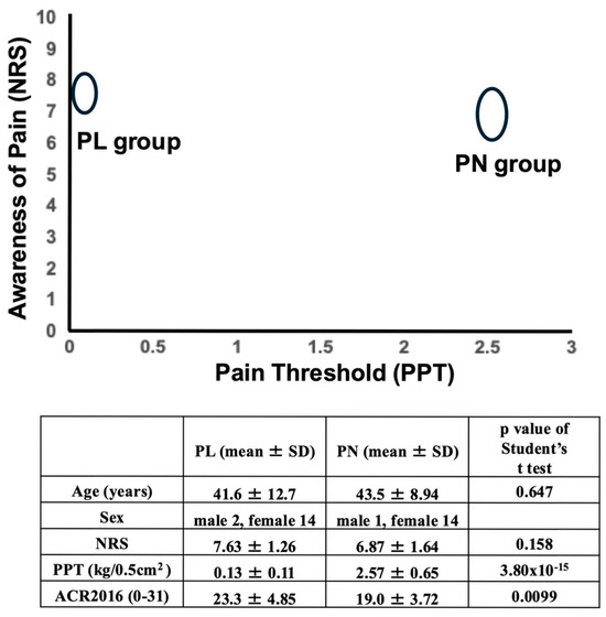 Fibromyalgia: A Multifactorial Pain Disorder
