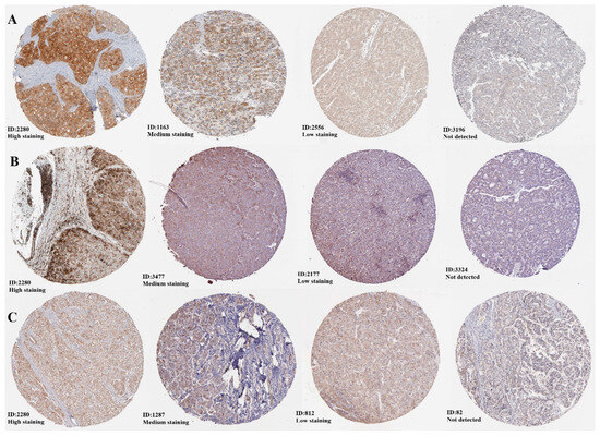 Integrative Bioinformatic Characterization of the HDAC6-Driven