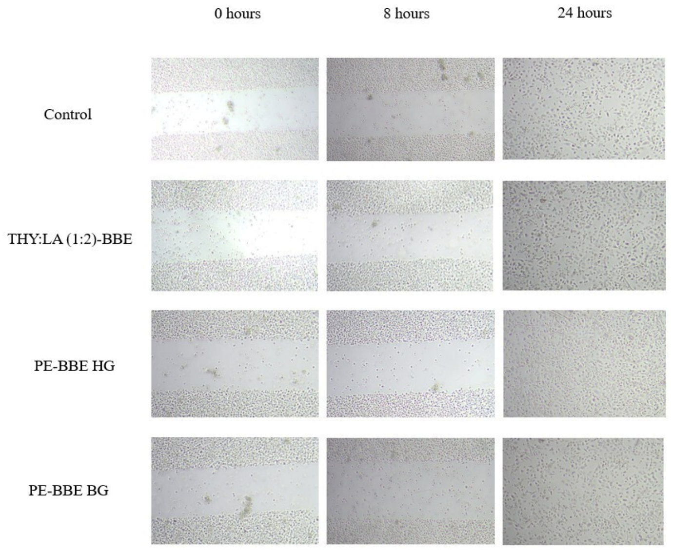 Ijms 27 05746 g005