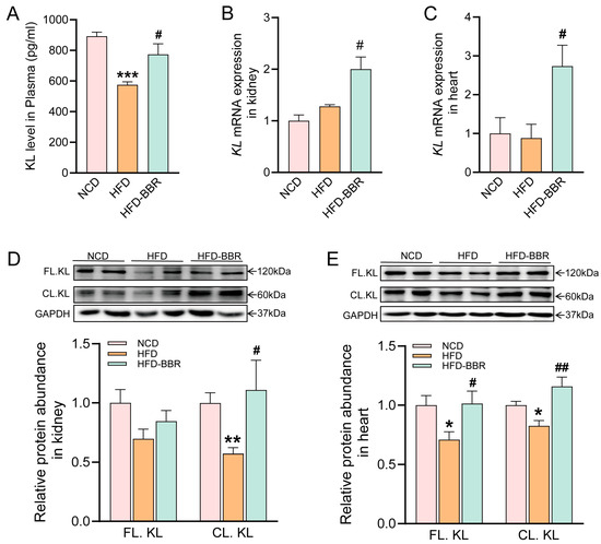 is glutathione good for asthma Berberine Stabilizes the Arrhythmogenic Substrate in Obese Rats by Klotho-Mediated Attenuation of Oxidative Stress and Inflammation