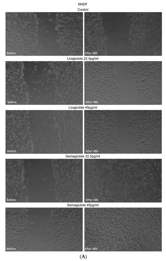 Semaglutide and Liraglutide Modulate Oxidative Stress and Wound Repair in Normal Human Skin Cells Exposed to an In Vitro Diabetic-like Environment