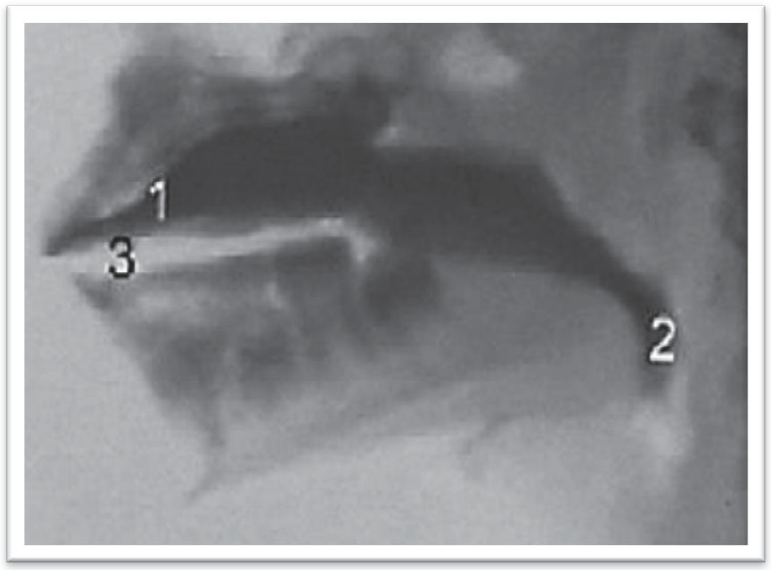 Ijom 39 00054 g004 Ijom 39 00054 g004