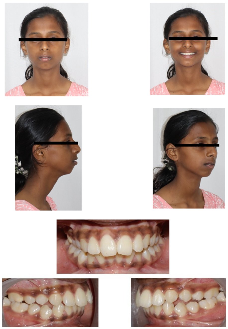 Ijom 52 00005 g004