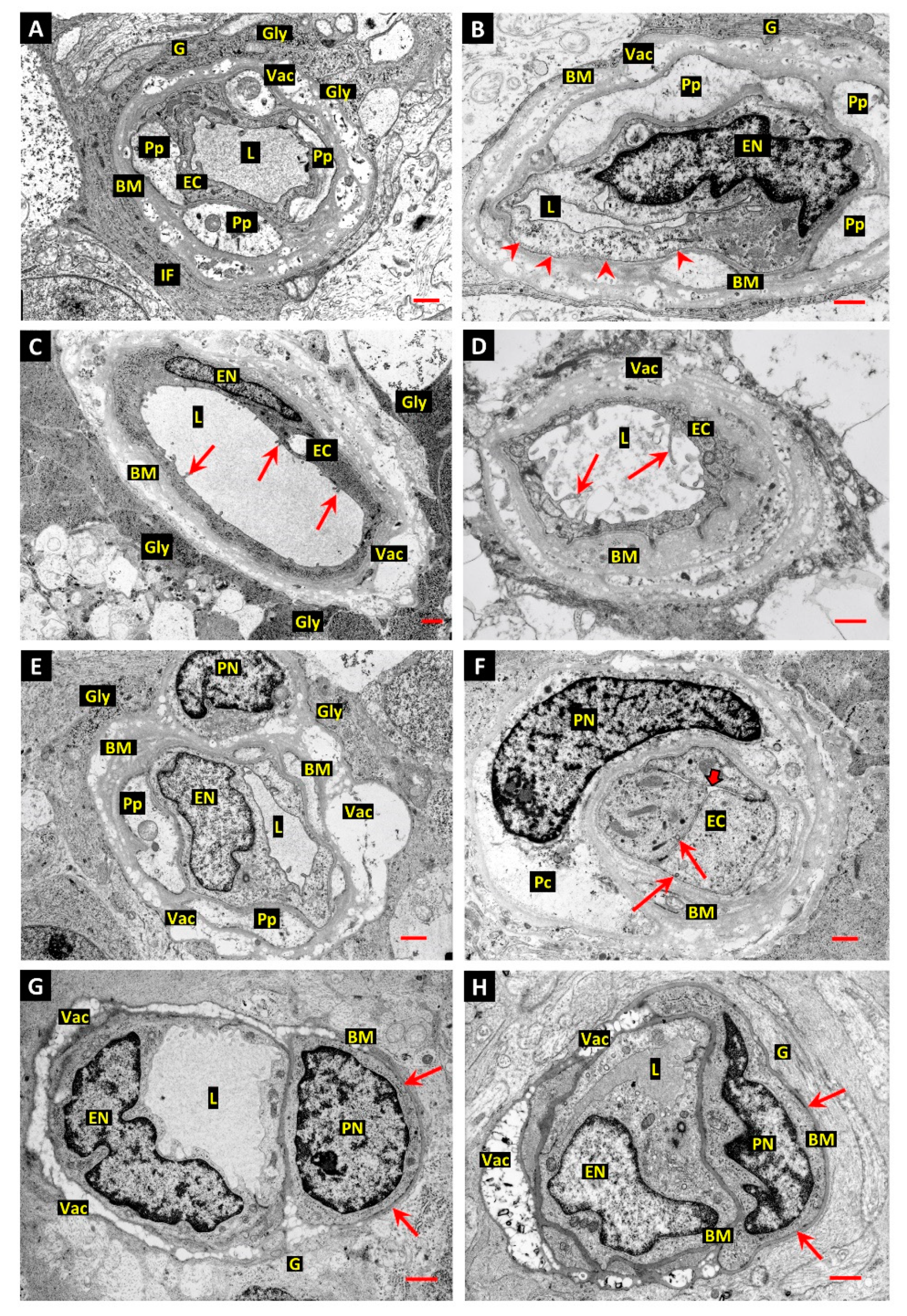 Ijtm 02 00003 g001 Ijtm 02 00003 g001