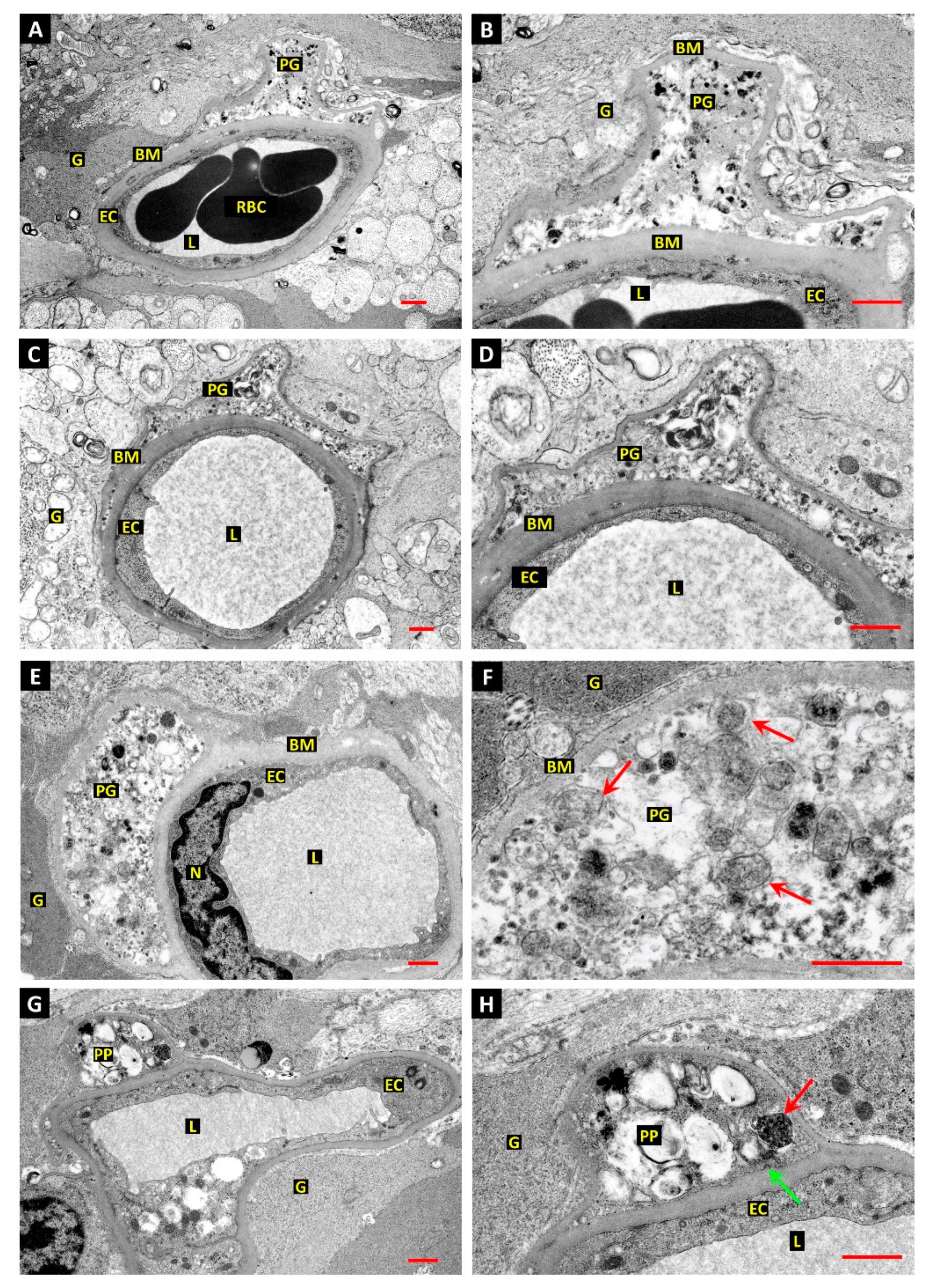 Ijtm 02 00003 g002 Ijtm 02 00003 g002