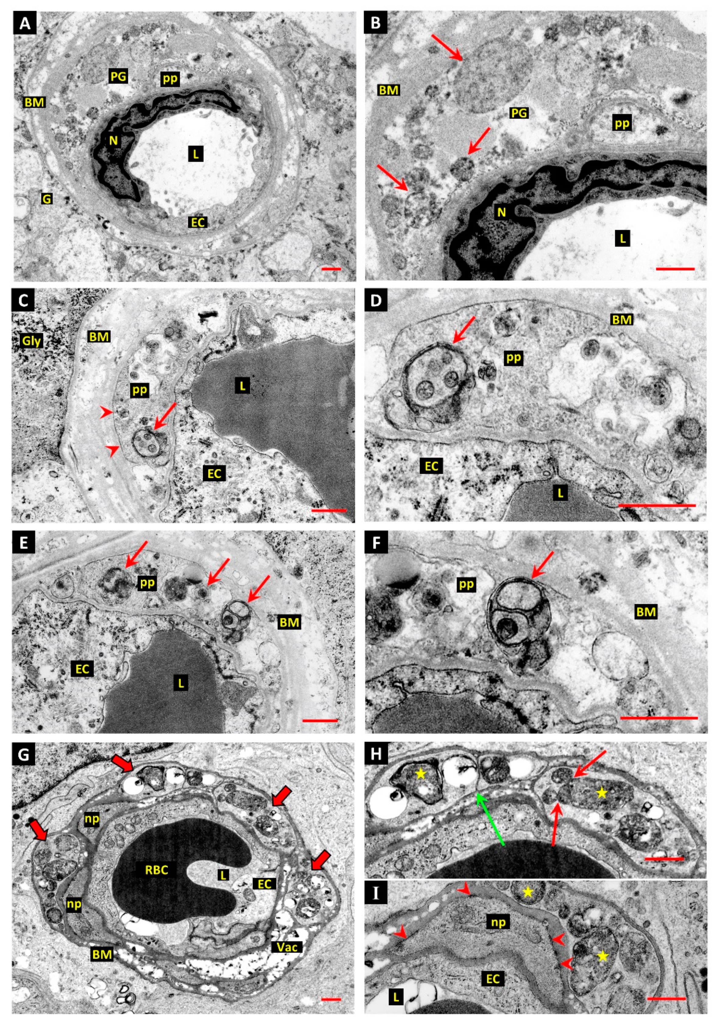 Ijtm 02 00003 g003 Ijtm 02 00003 g003