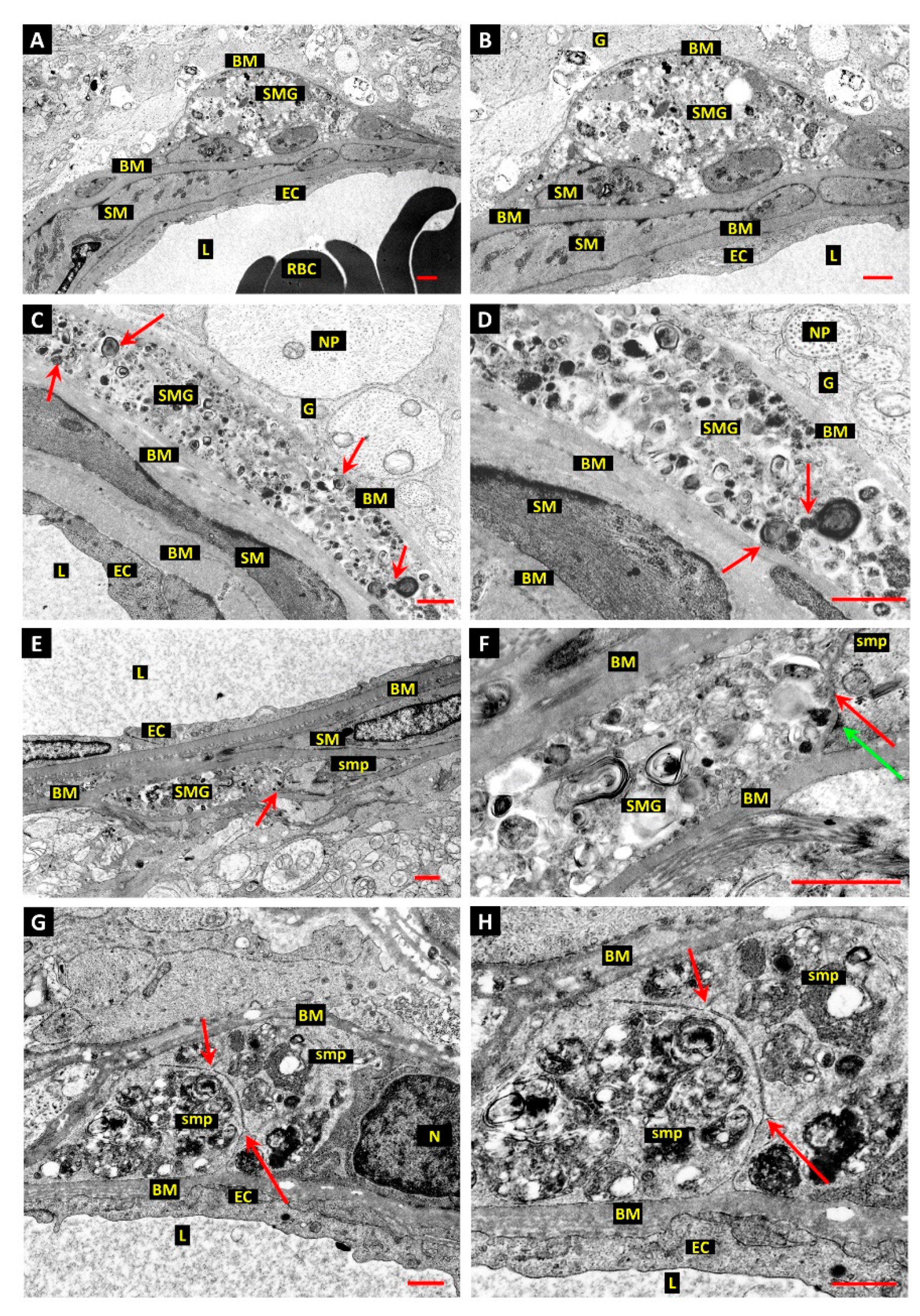 Ijtm 02 00003 g004 Ijtm 02 00003 g004