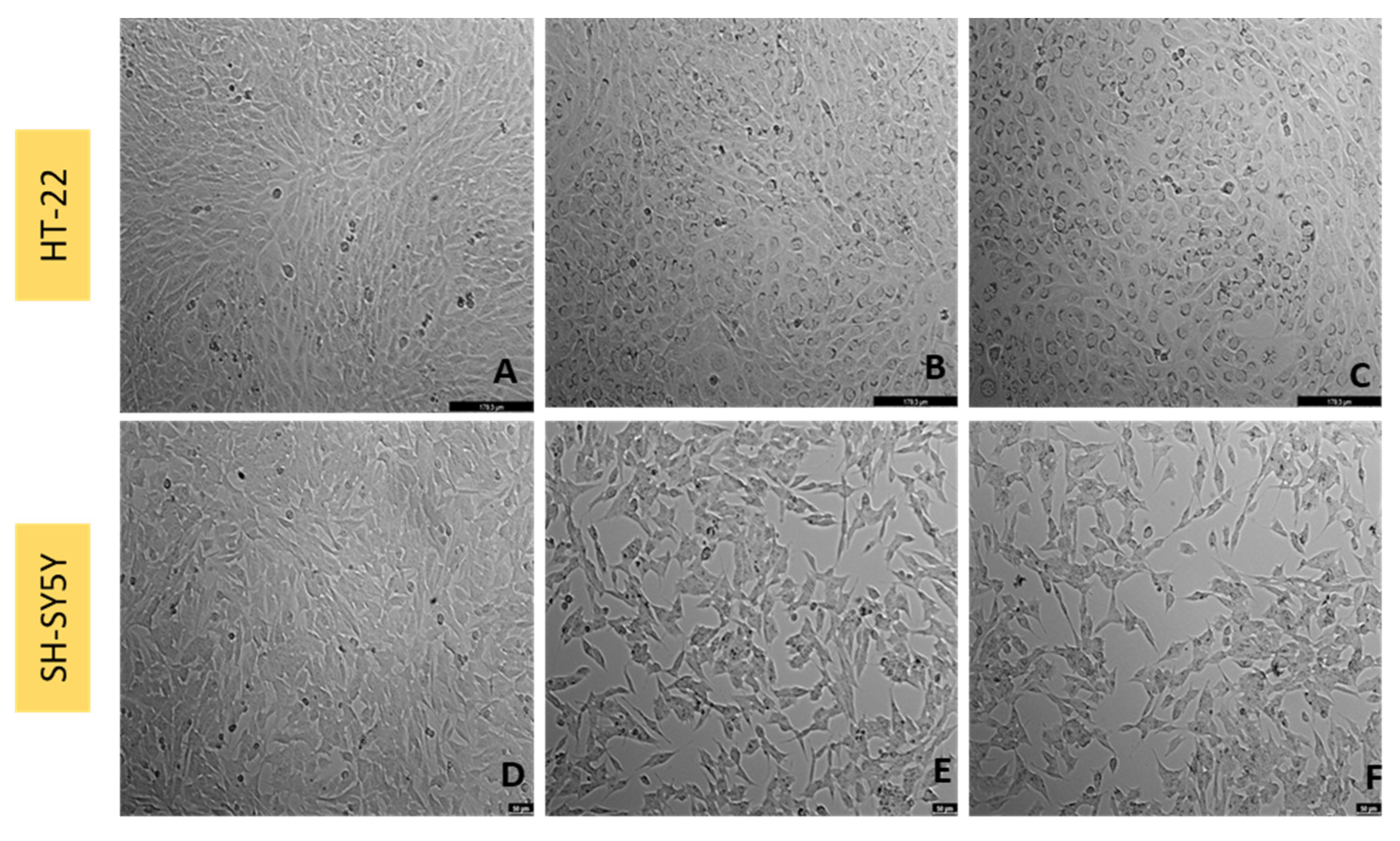 Ijtm 02 00036 g010 550