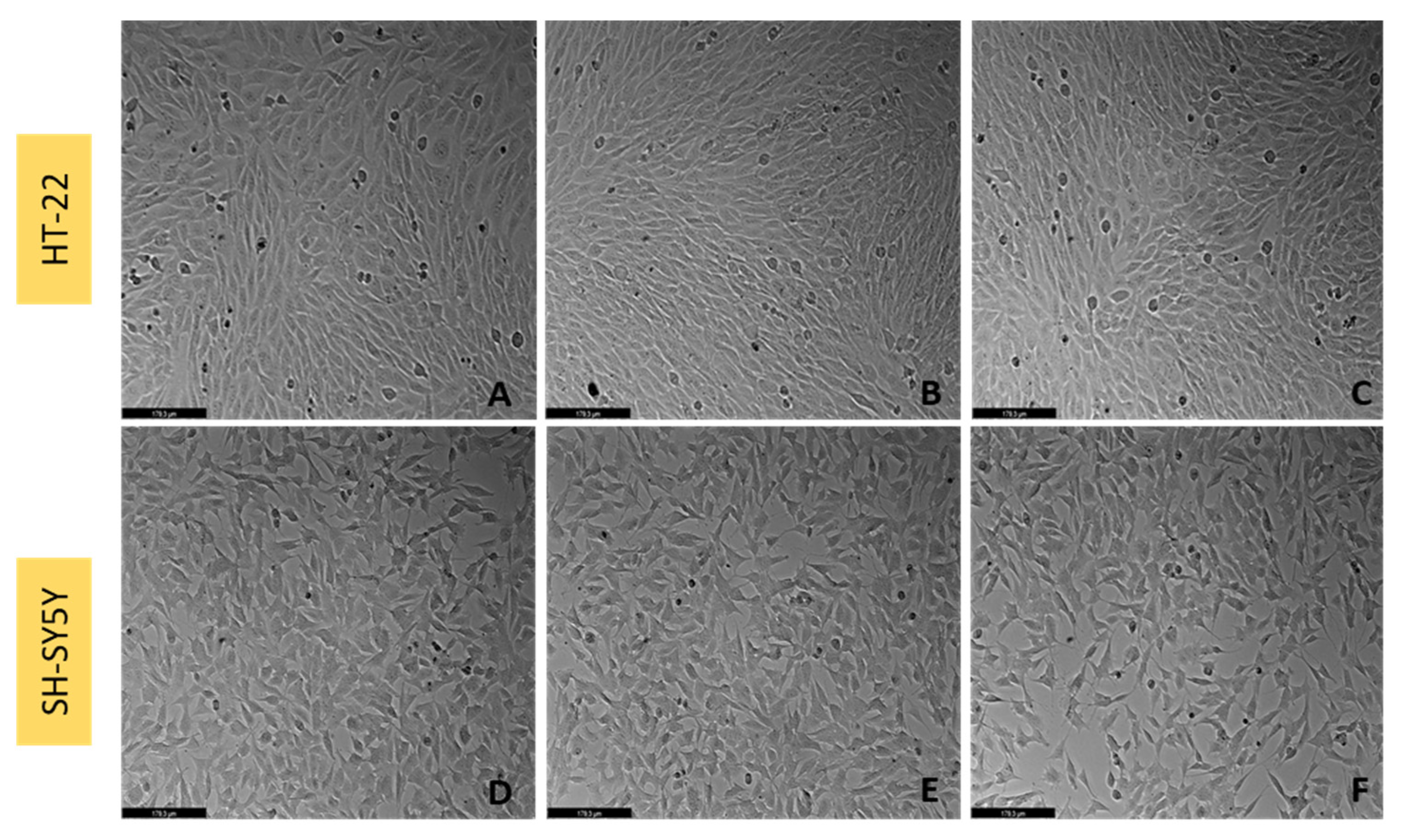 Ijtm 02 00036 g012 550