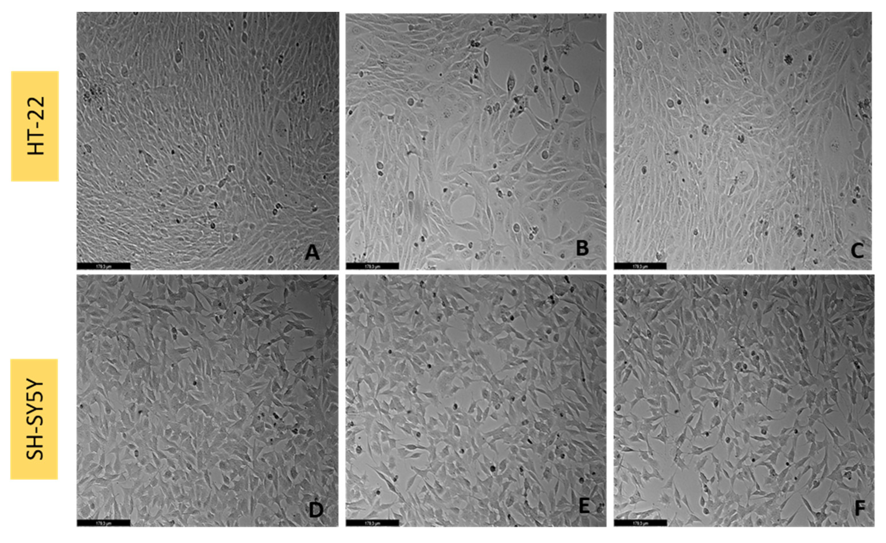 Ijtm 02 00036 g014 550