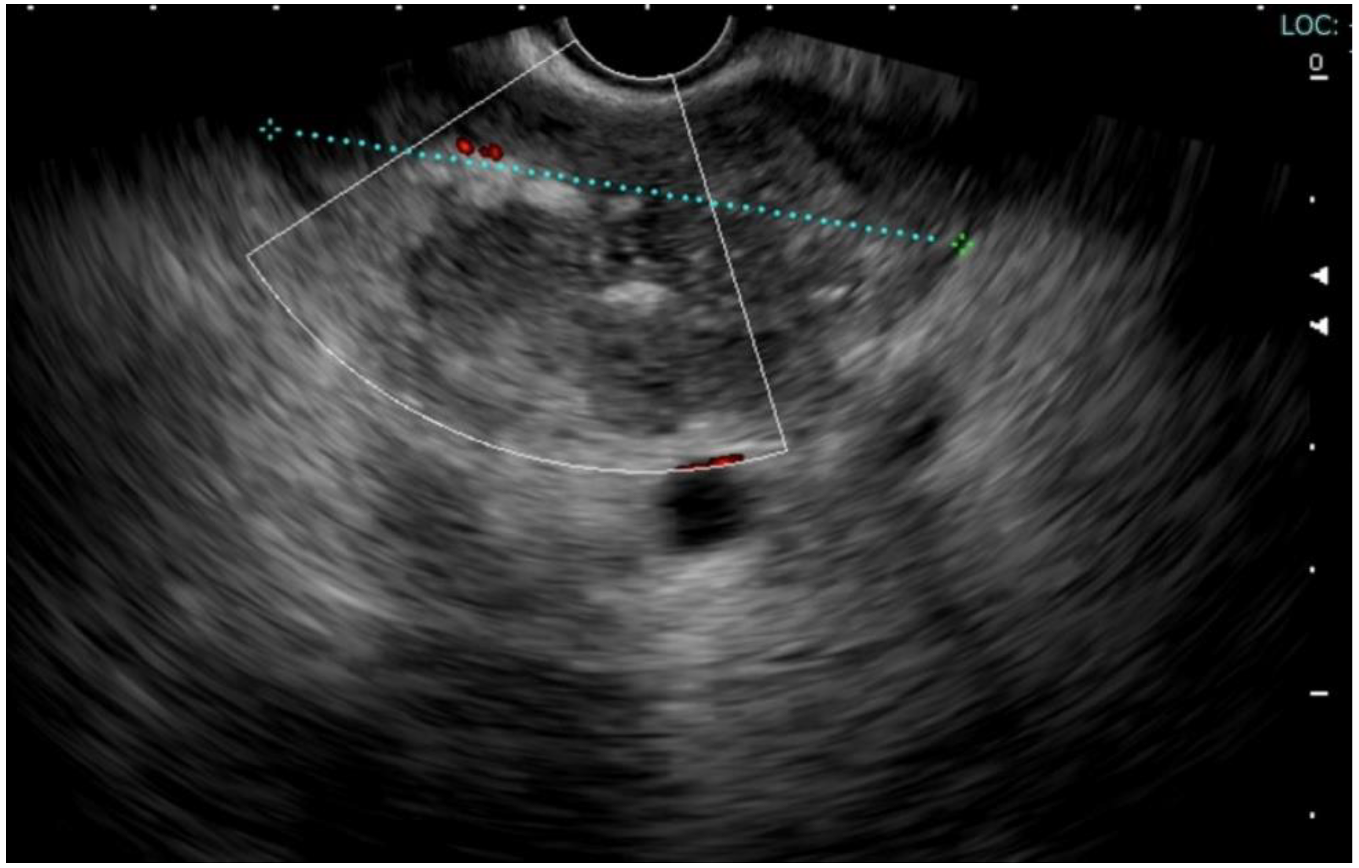 Ijtm 02 00040 g003 Ijtm 02 00040 g003