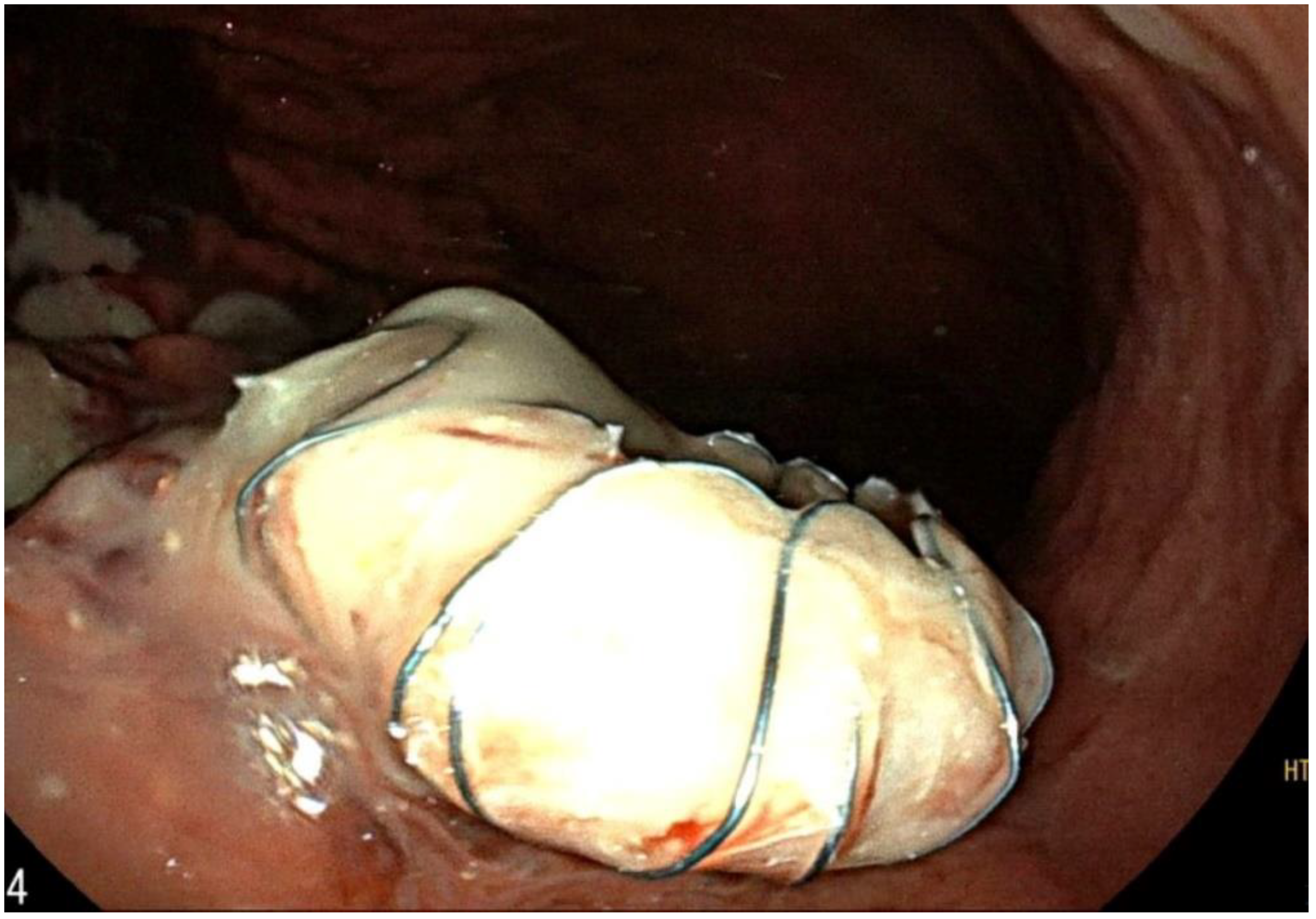 Ijtm 02 00040 g004 Ijtm 02 00040 g004