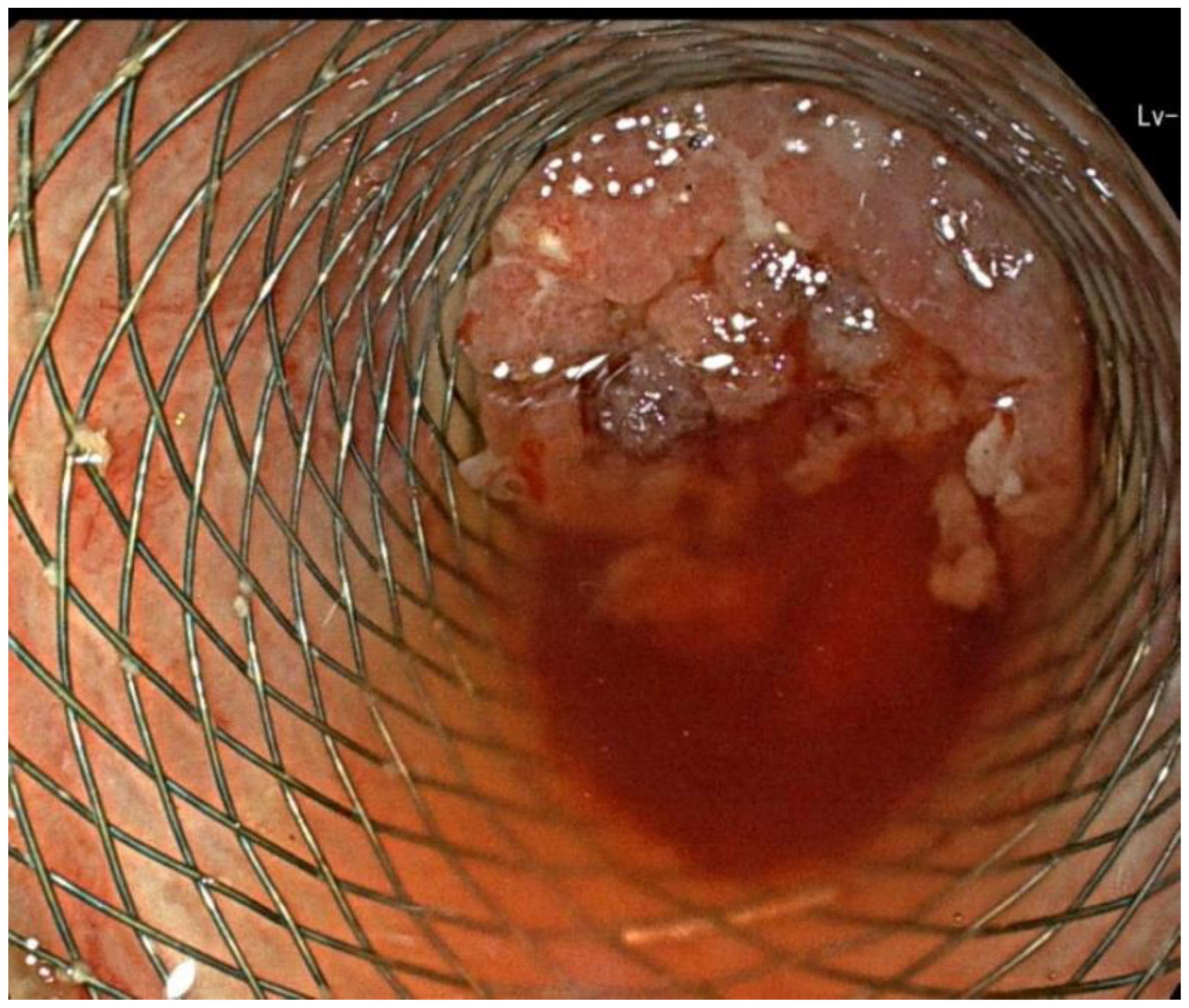 Ijtm 02 00040 g007 Ijtm 02 00040 g007