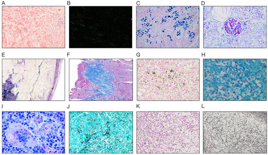 Enhancing Pathology Education Through Special Staining Integration: A ...