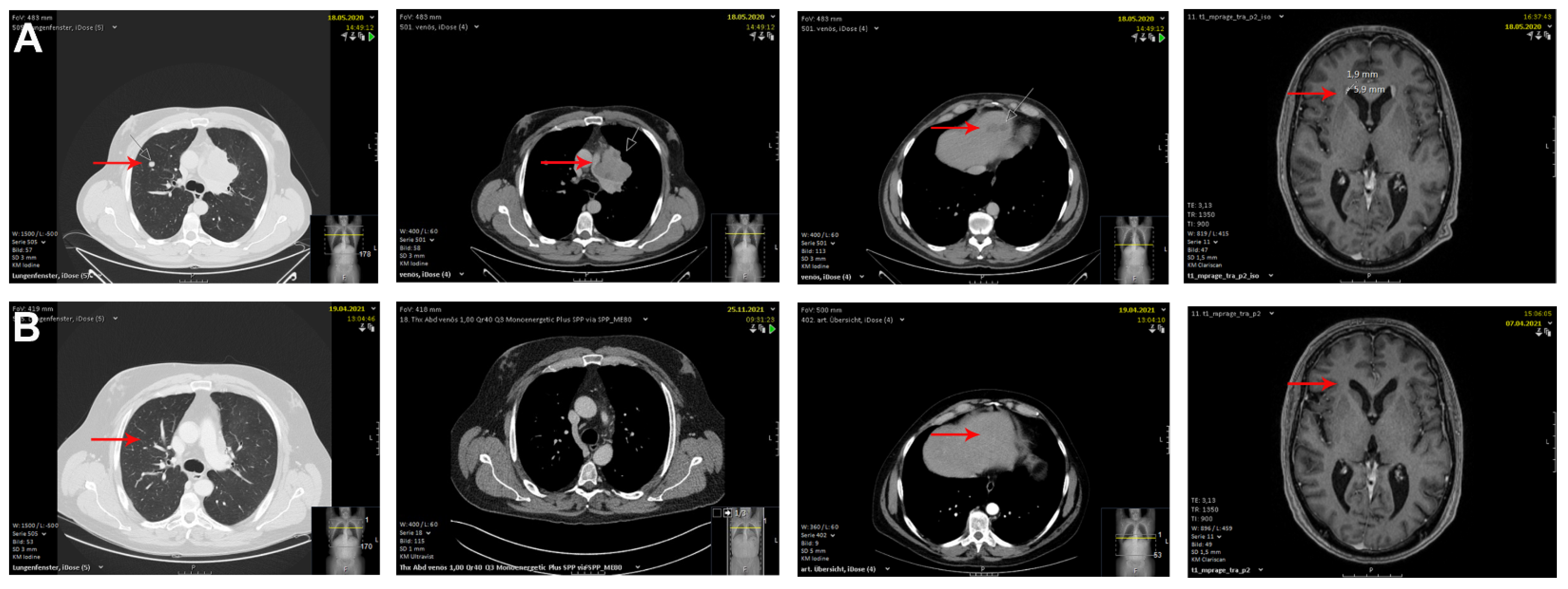 Immuno 02 00020 g005