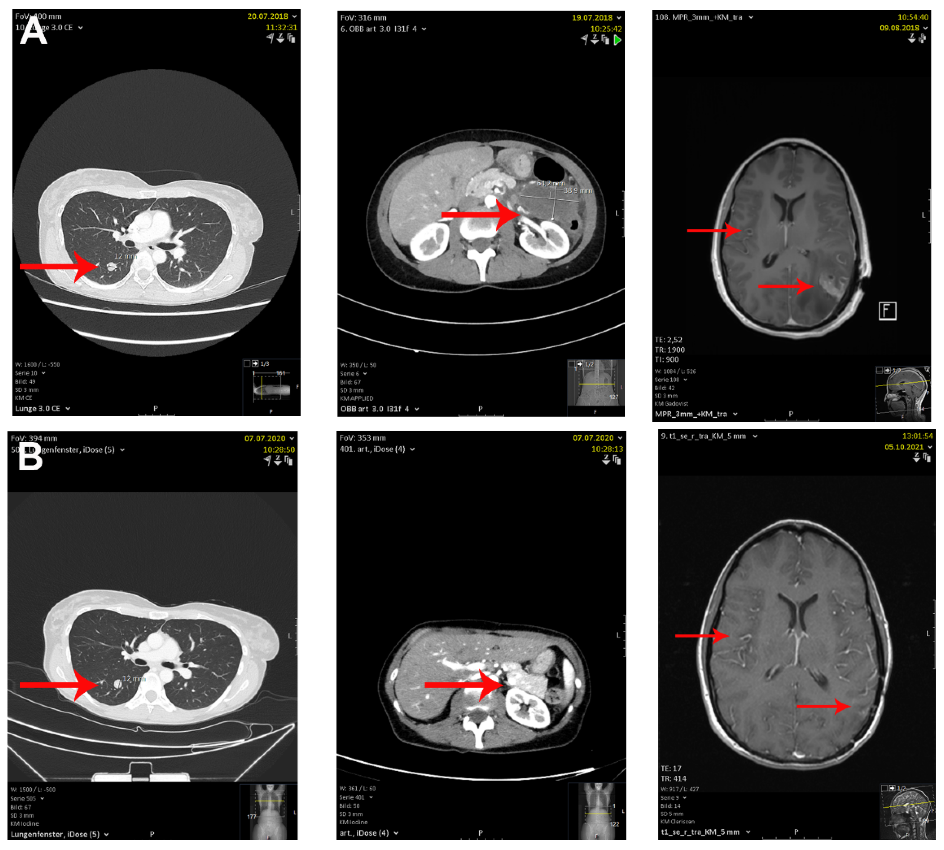Immuno 02 00020 g006