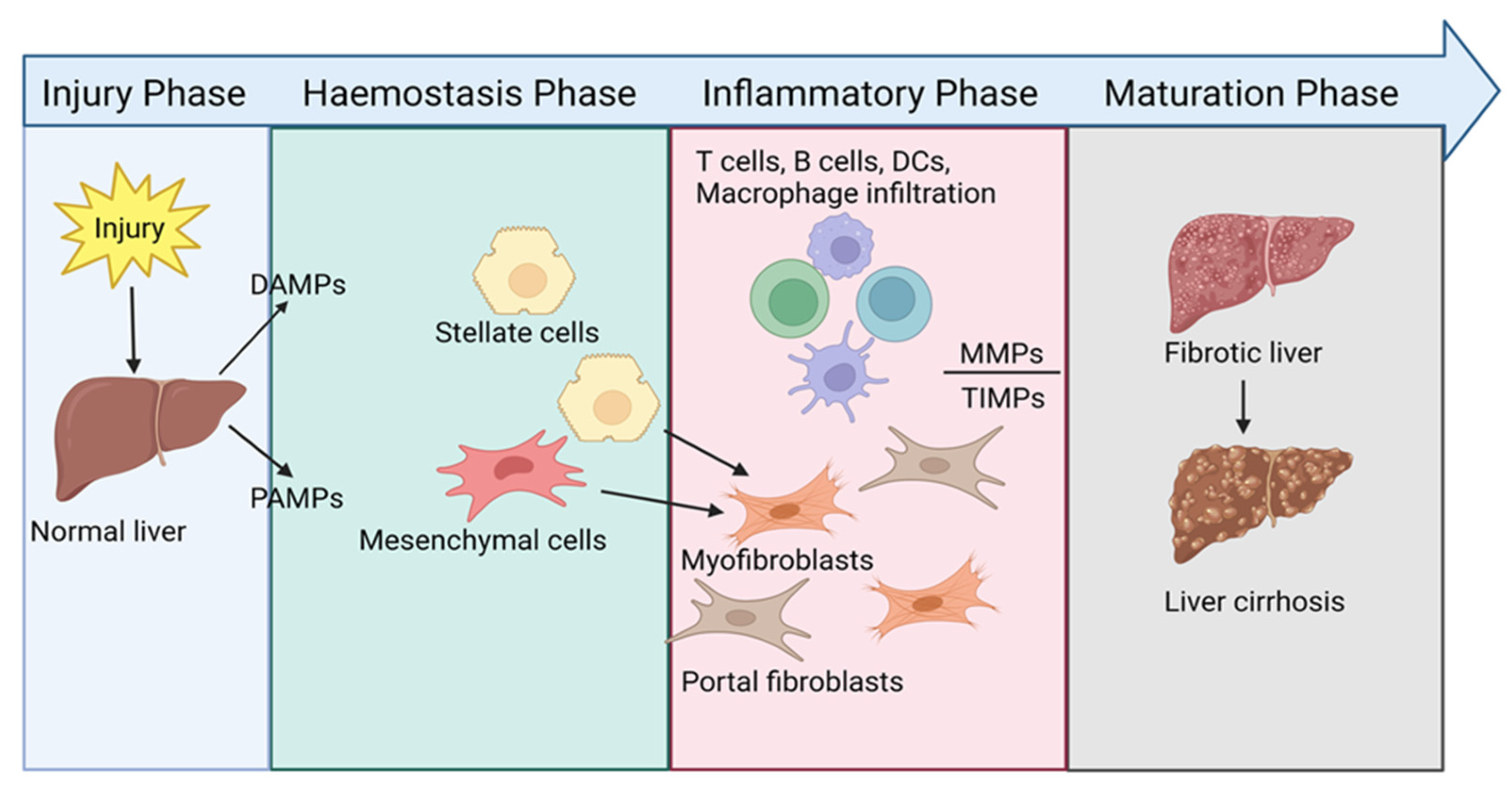 Immuno Free FullText Inflammatory Network of Liver Fibrosis and