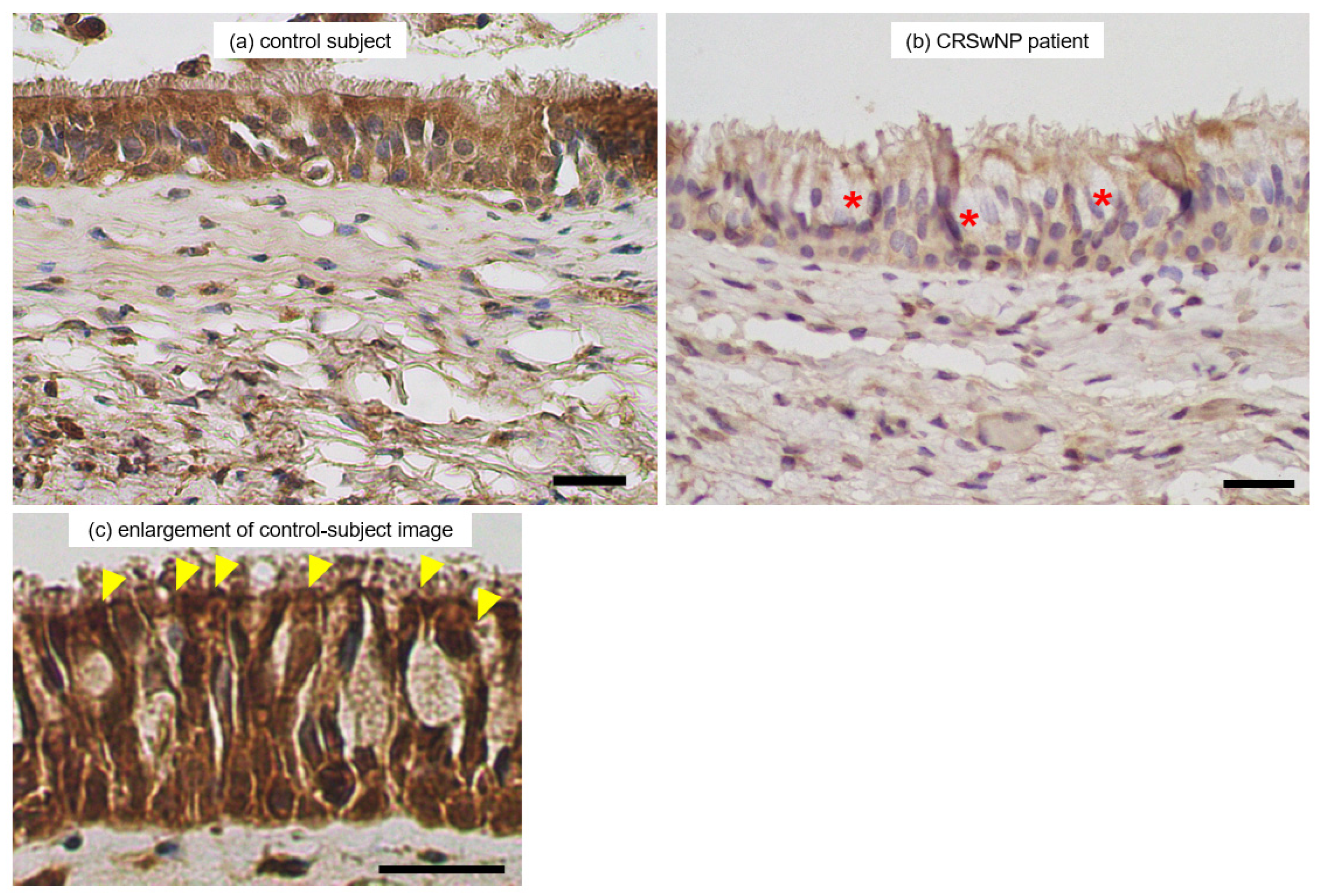 Immuno 04 00016 g007 Immuno 04 00016 g007