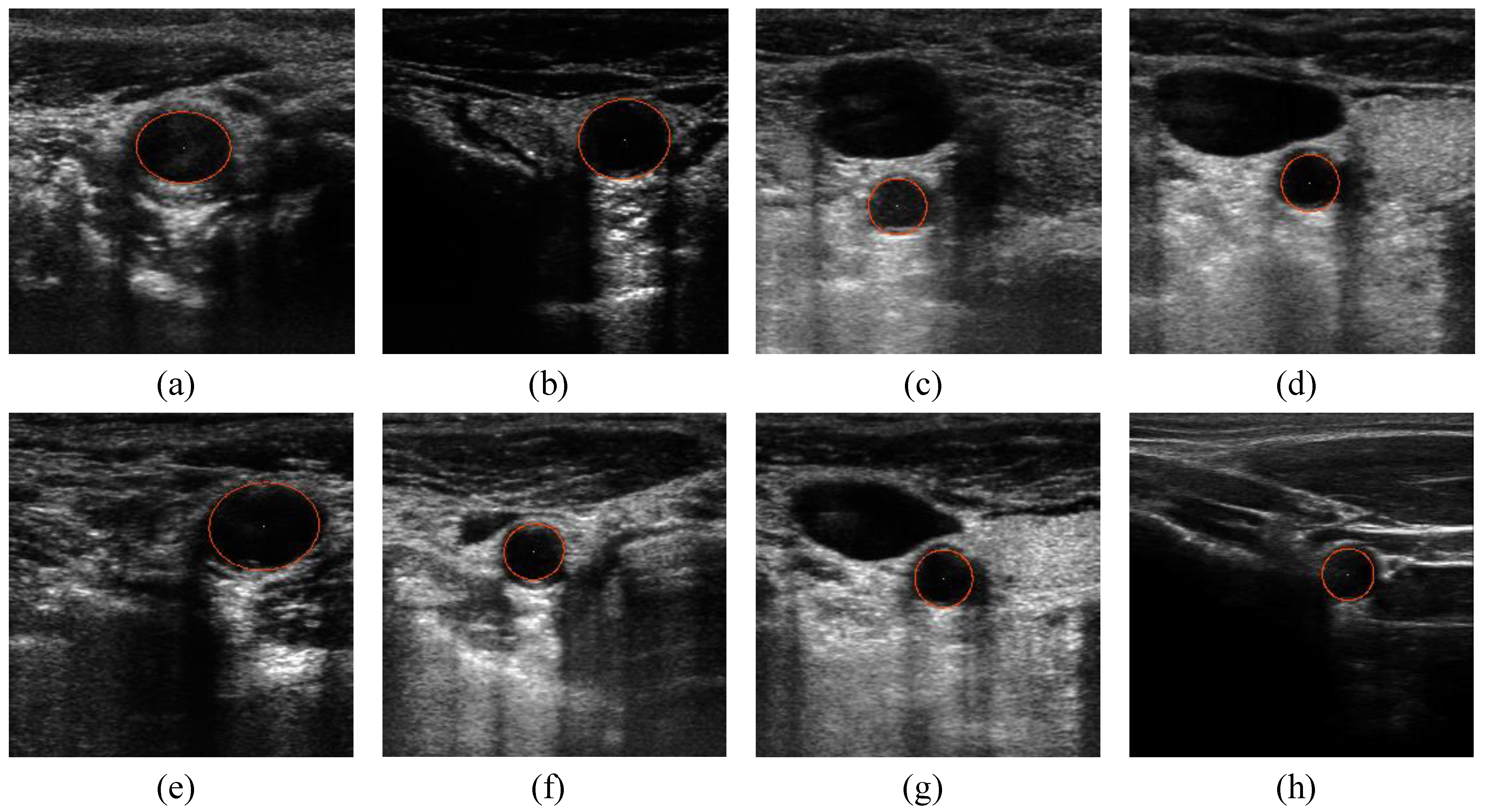Image segmentation of ultrasound images - CORE ultrasound image segmentation thesis
