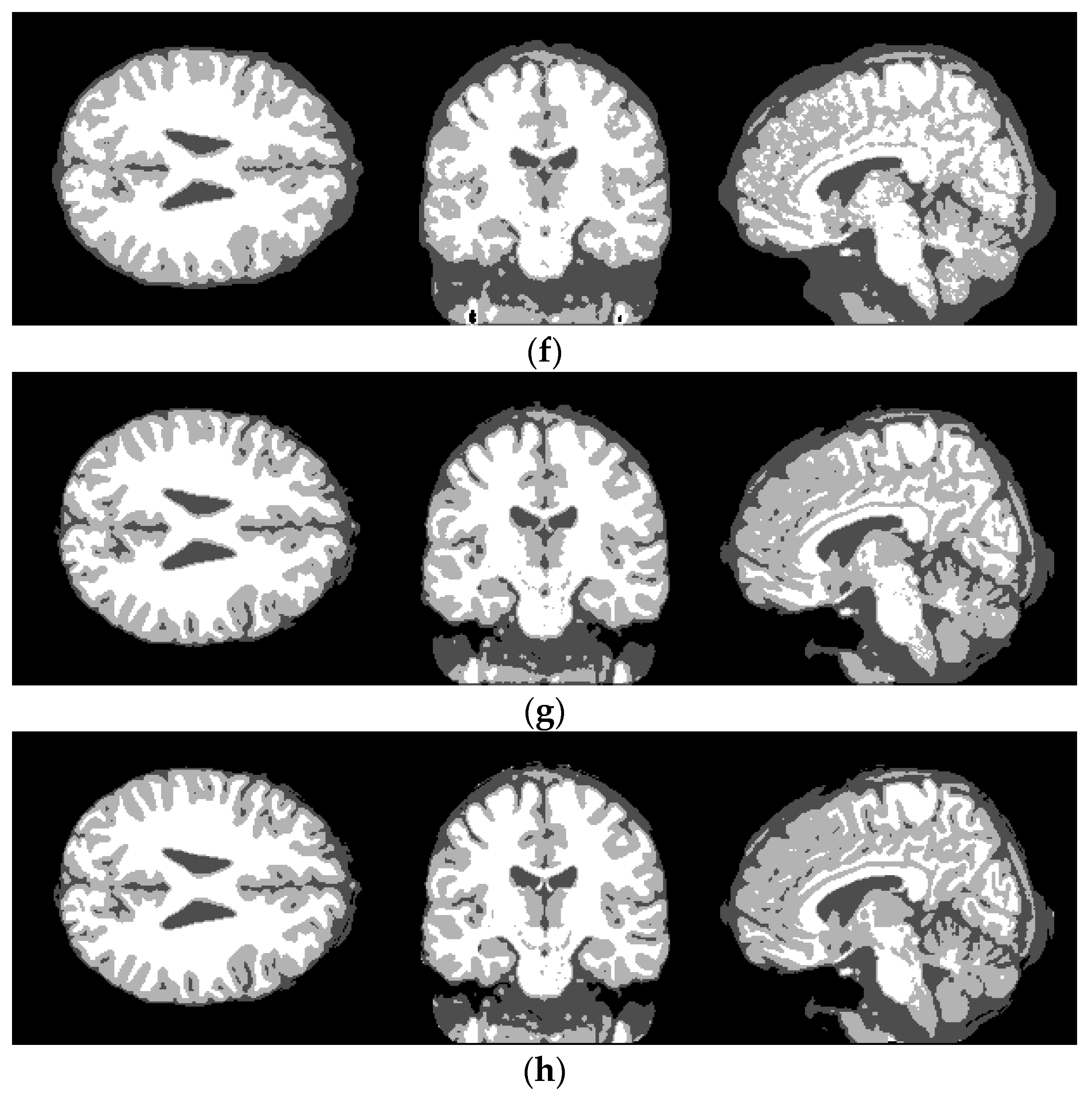 Information 10 00074 g005b