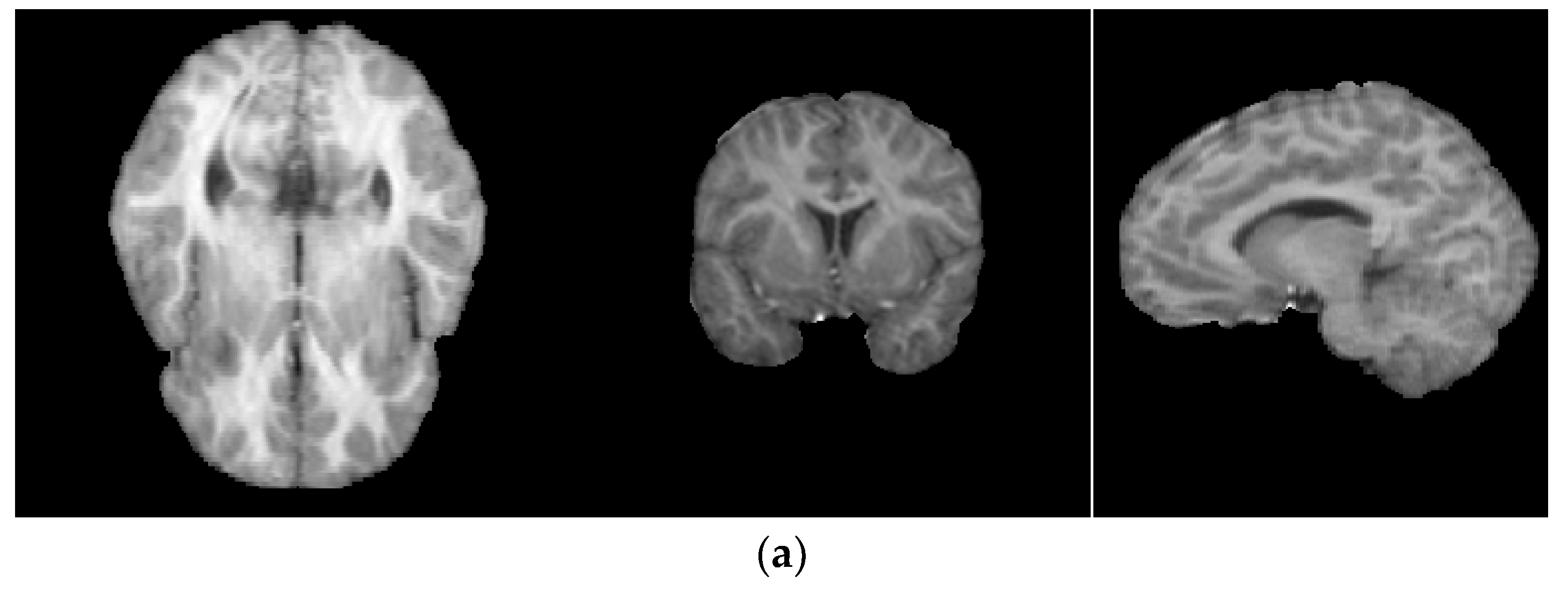 Information 10 00074 g007a