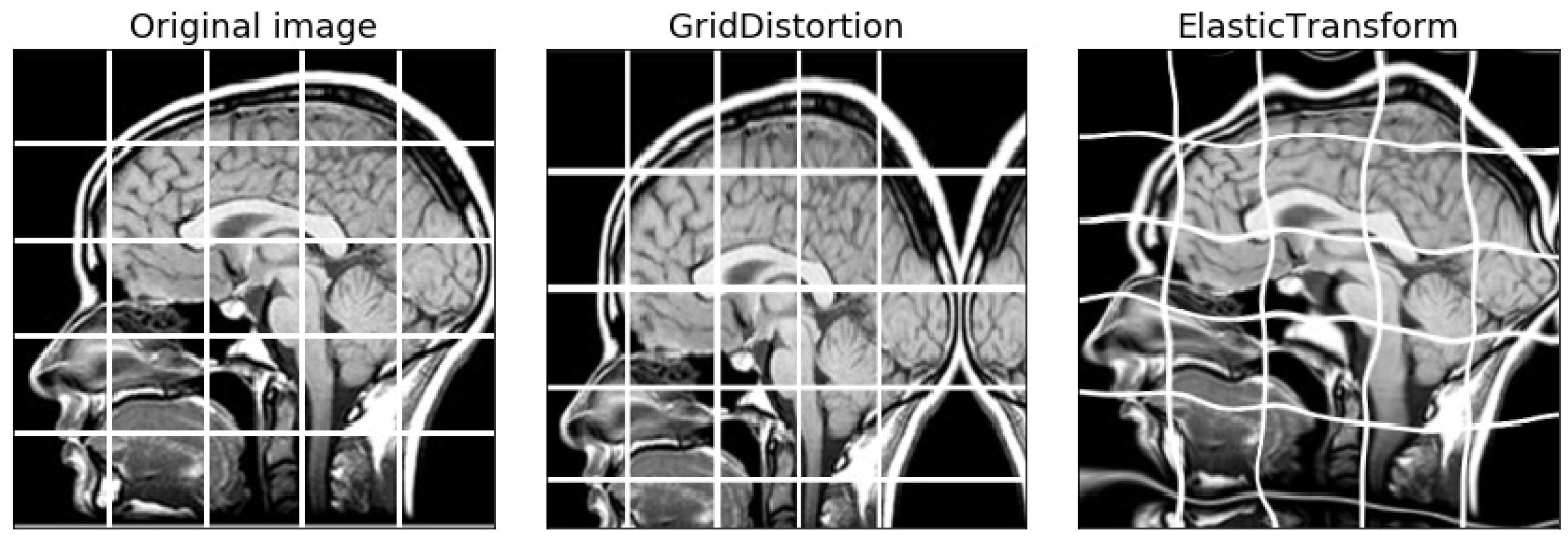 Information 11 00125 g002