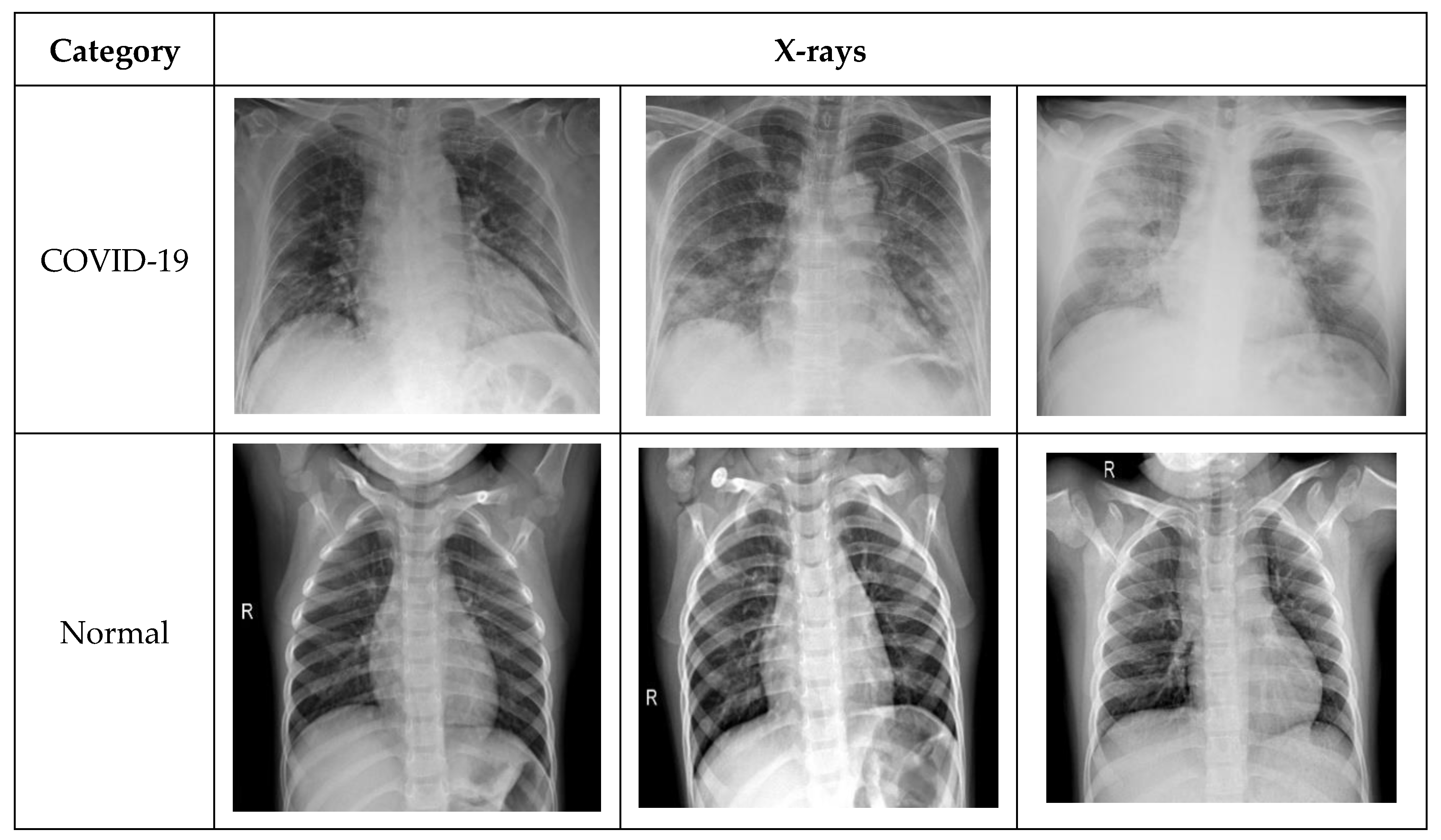 Information Free Full Text A Deep Learning Based Framework For Automated Diagnosis Of Covid 19 Using X Ray Images Html